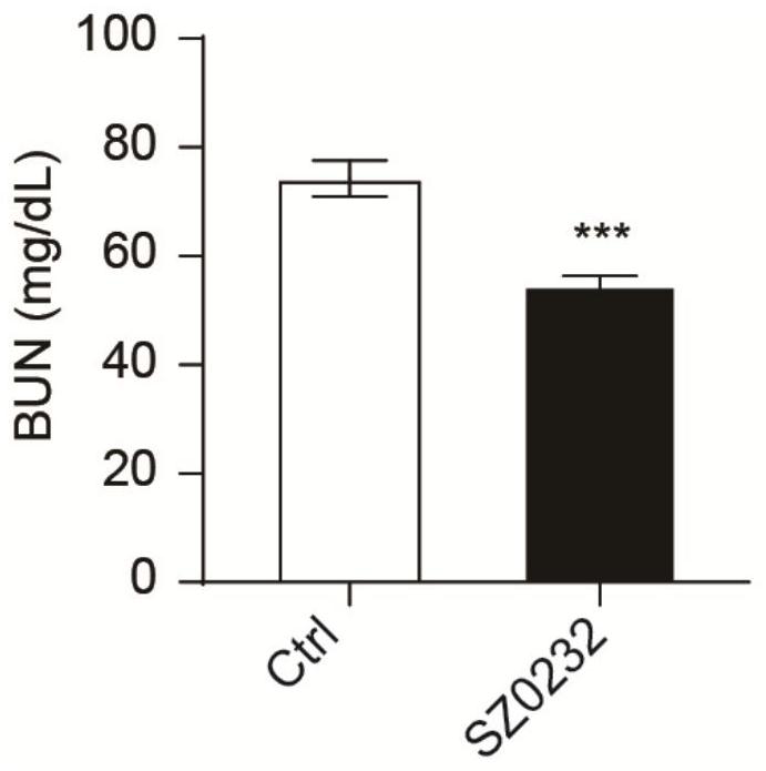 Application of benzenesulfonamide compound in preparation of medicine for treating acute kidney injury