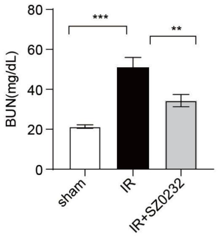 Application of benzenesulfonamide compound in preparation of medicine for treating acute kidney injury