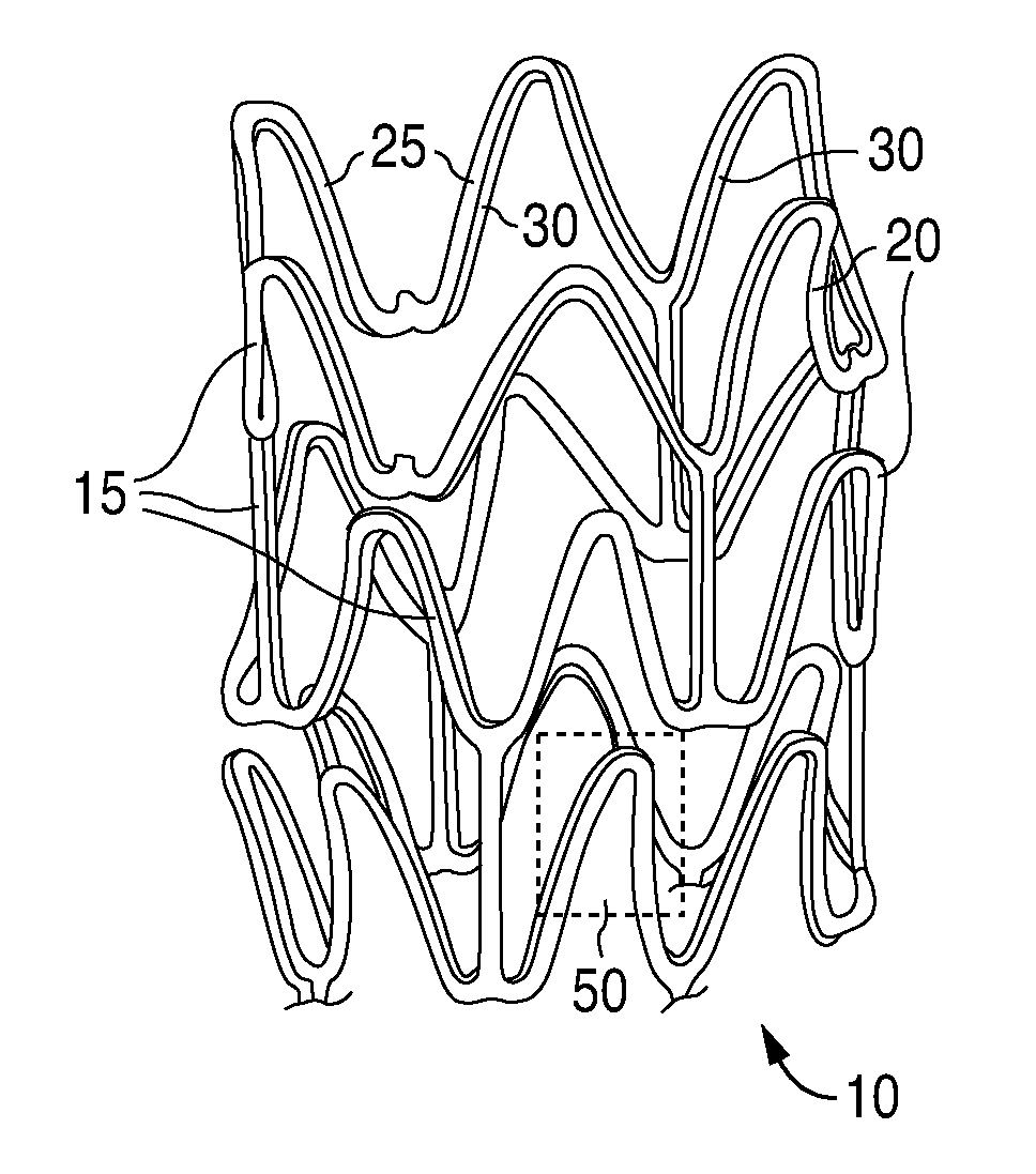 Anti-Proliferative and Anti-Inflammatory Agent Combination for Treatment of Vascular Disorders with an Implantable Medical Device