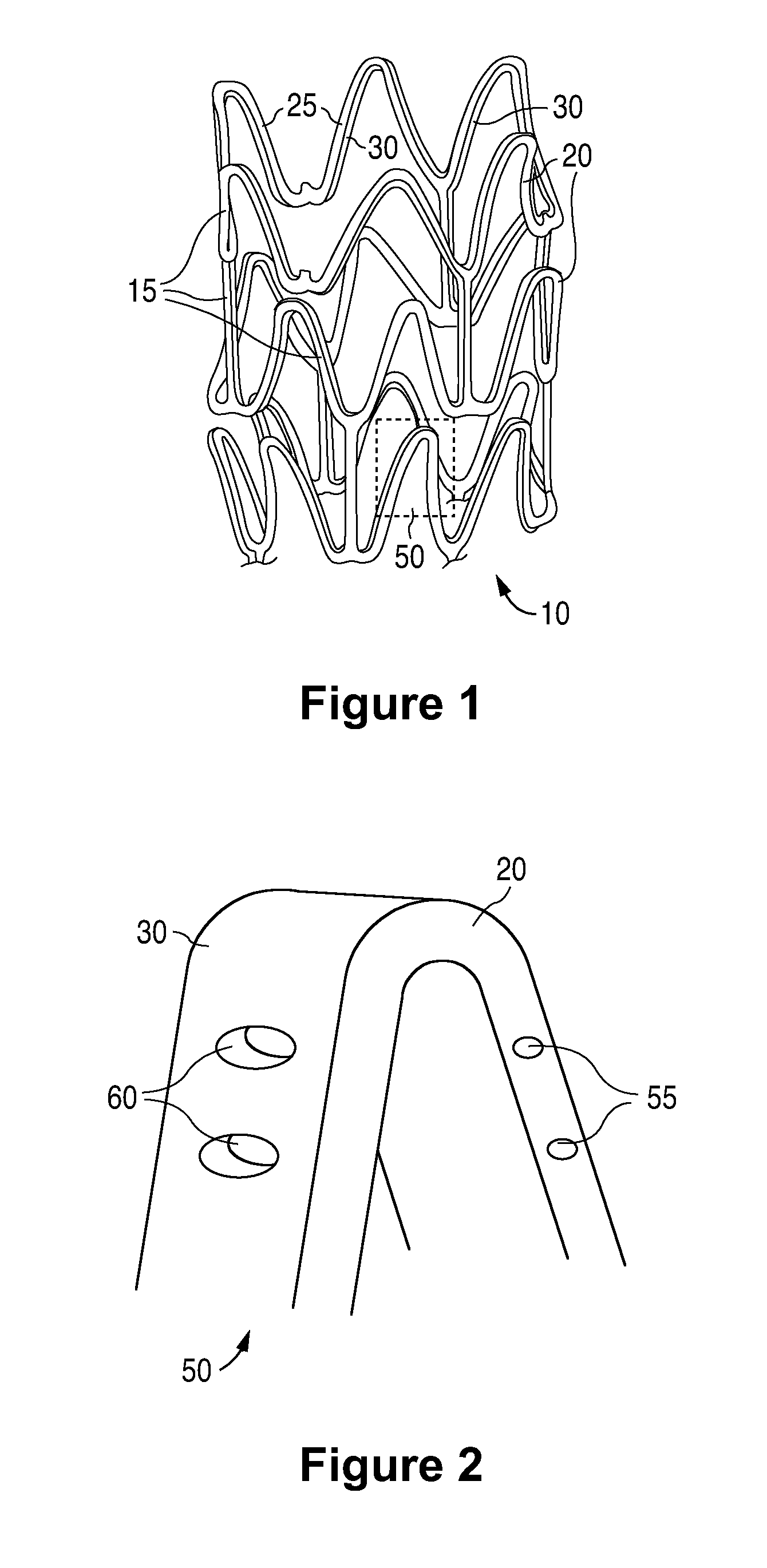 Anti-Proliferative and Anti-Inflammatory Agent Combination for Treatment of Vascular Disorders with an Implantable Medical Device