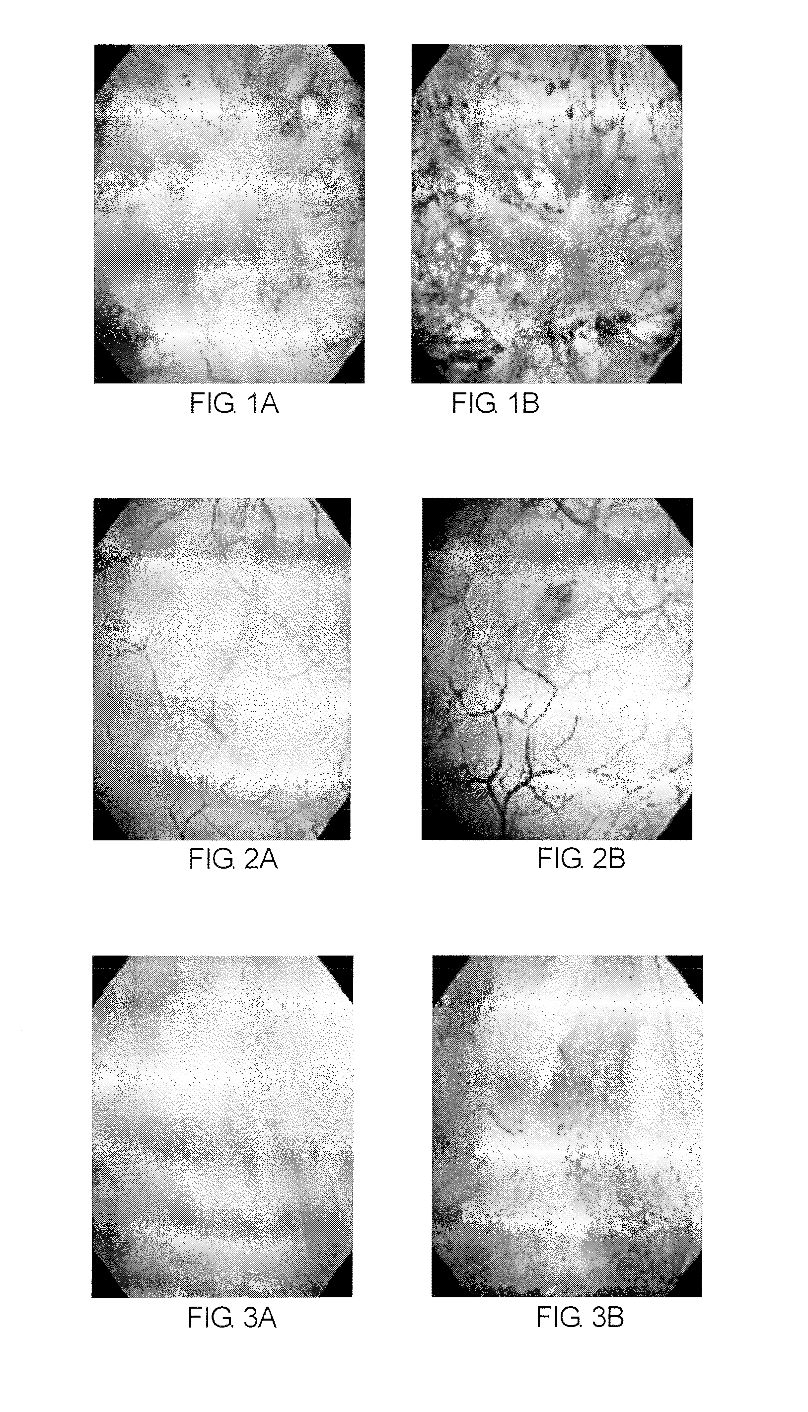 Method of diagnosing a lower urinary tract disorder
