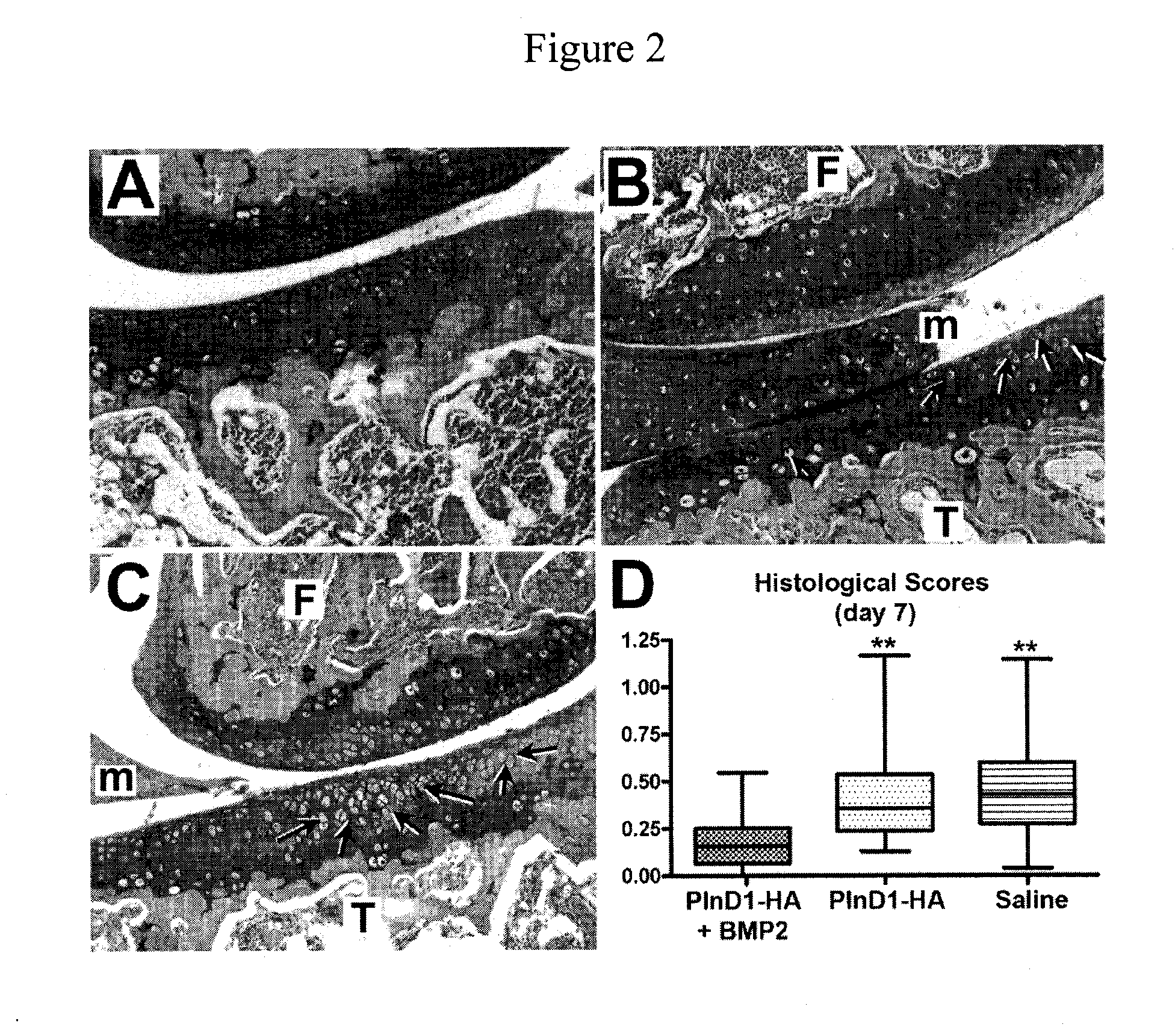 Injectable delivery system for heparan-binding growth factors