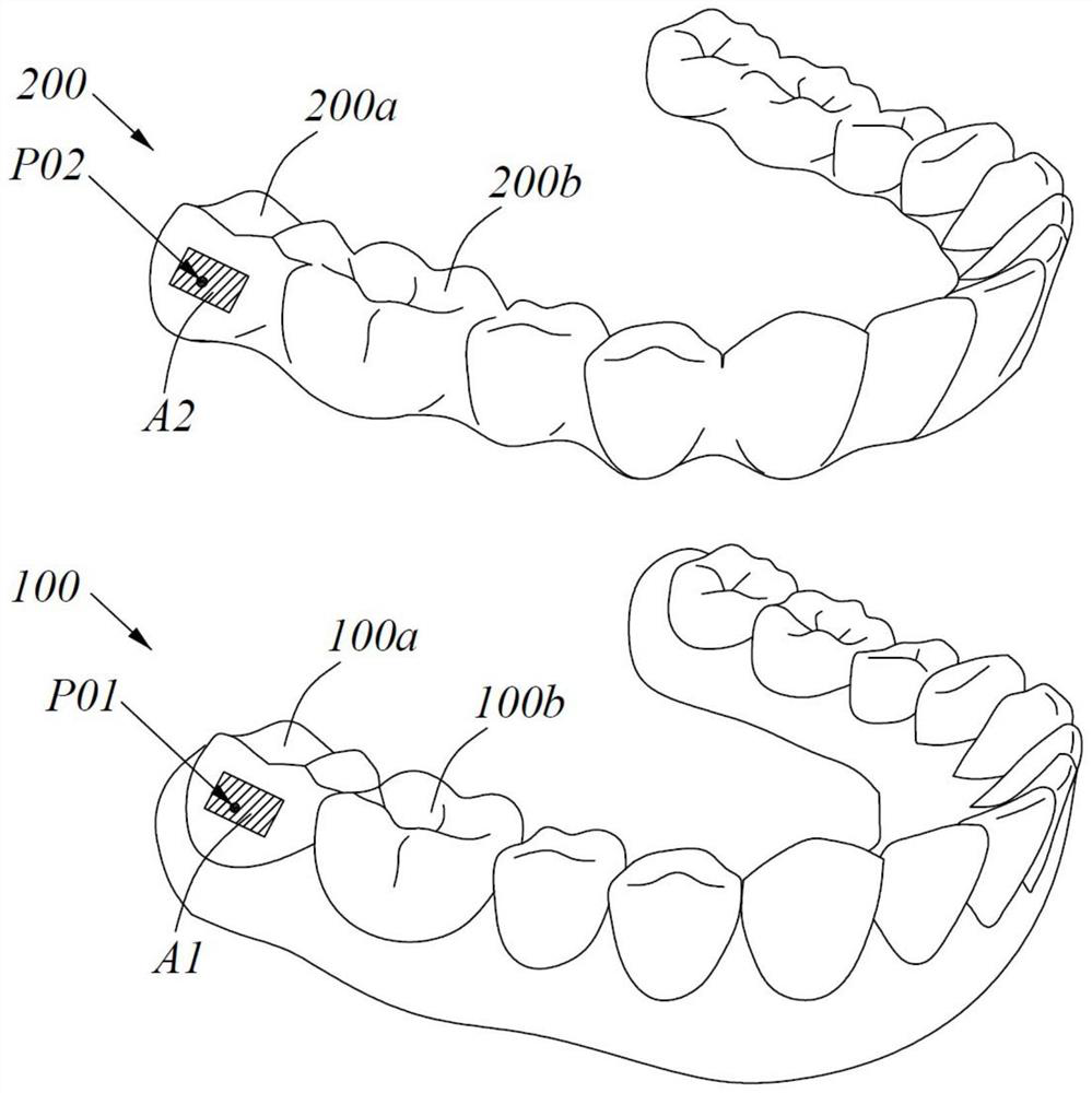 Construction method and system of retention accessory and bracket-free invisible orthodontic appliance