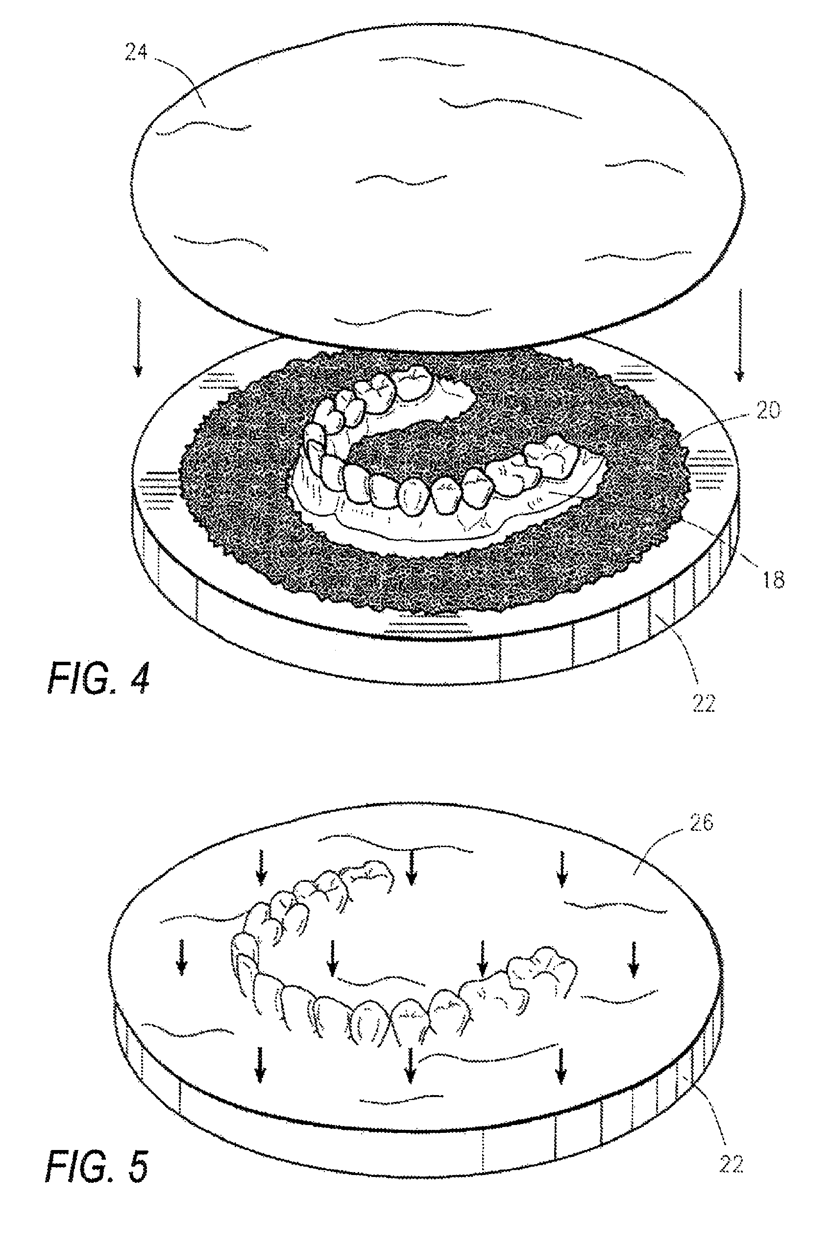 Implant prosthodontics and methods of preparing and seating the same