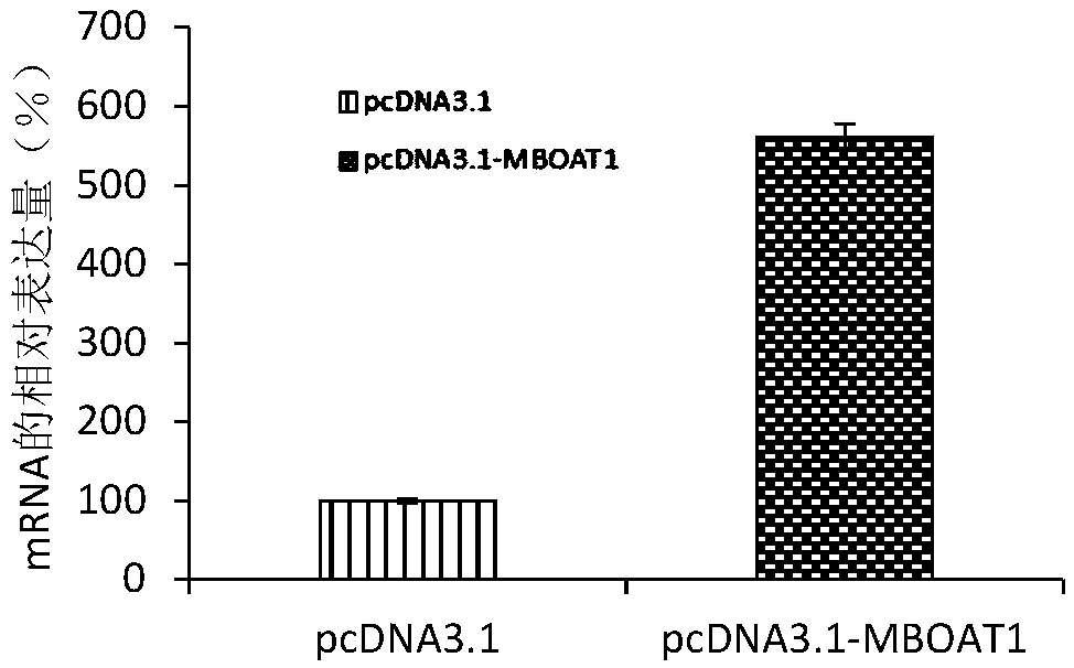 Application of MBOAT1 gene in preeclampsia