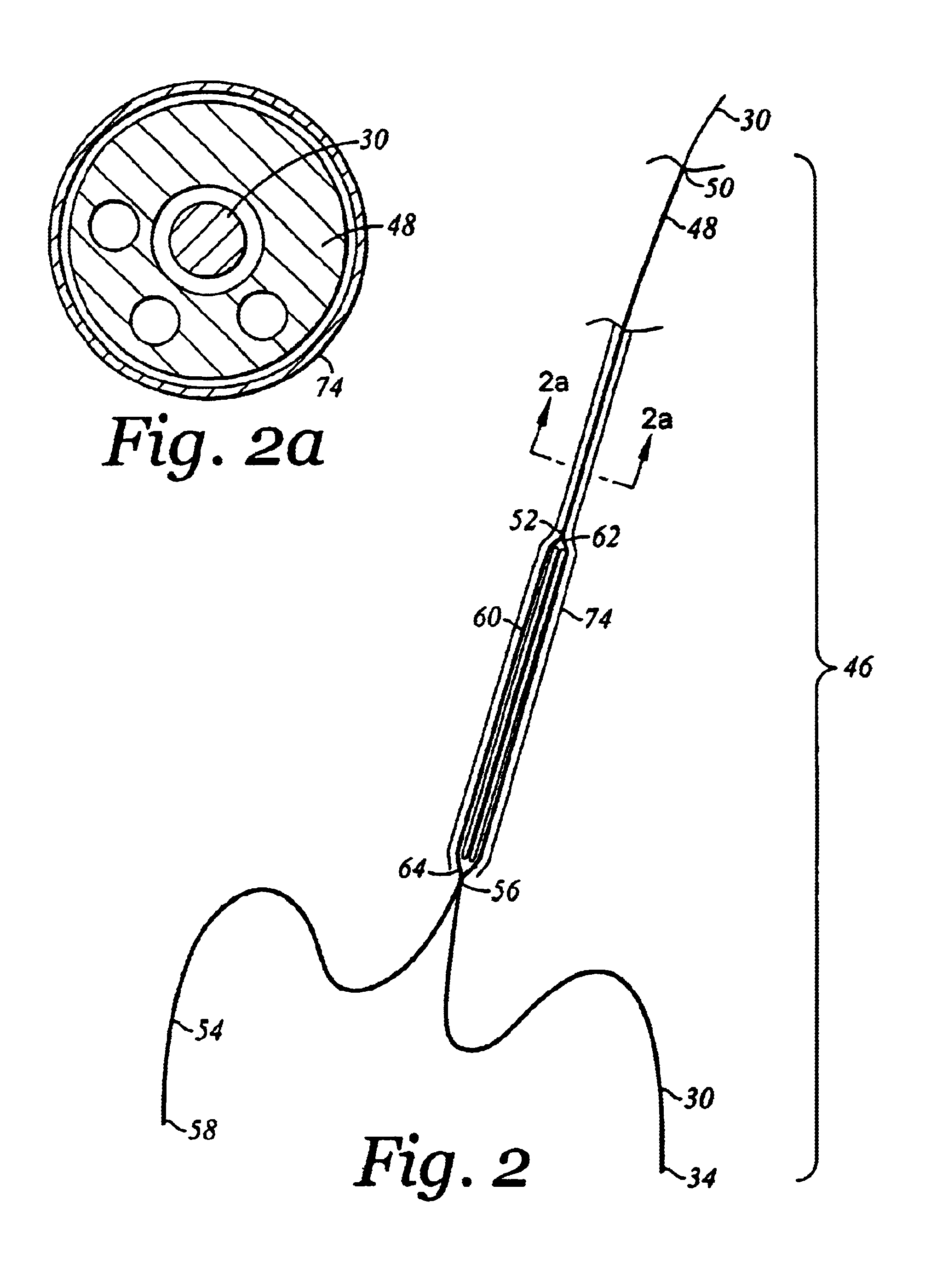 Device and method for staged implantation of a graft for vascular repair