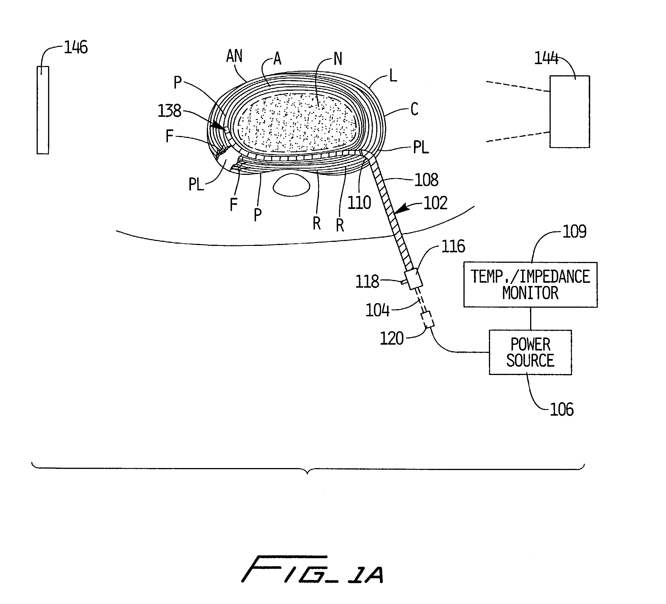 Apparatus and method for treatment of an intervertebral disc