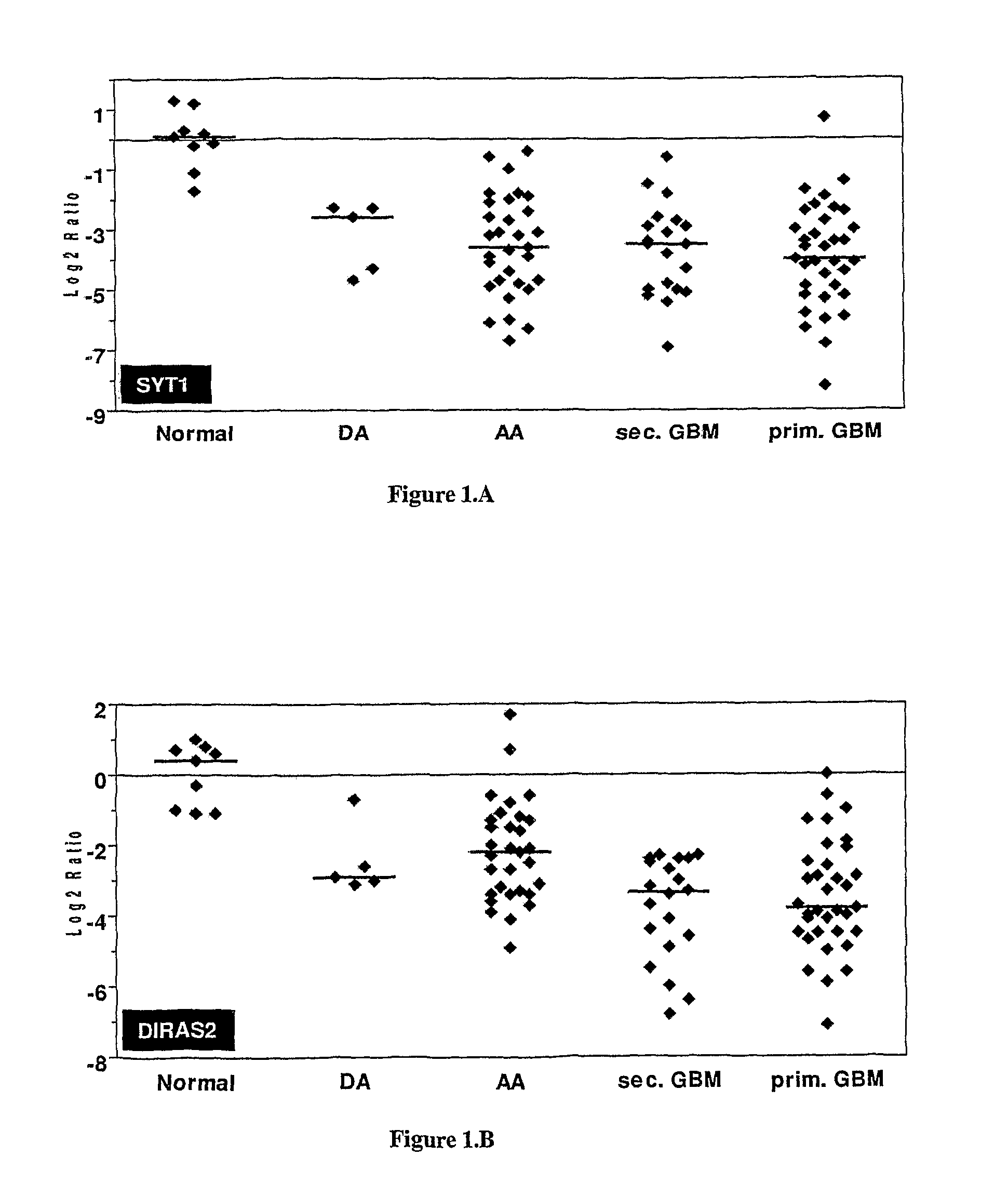 Methods and kits useful for the identification of astrocytoma, it's grades and glioblastoma prognosis