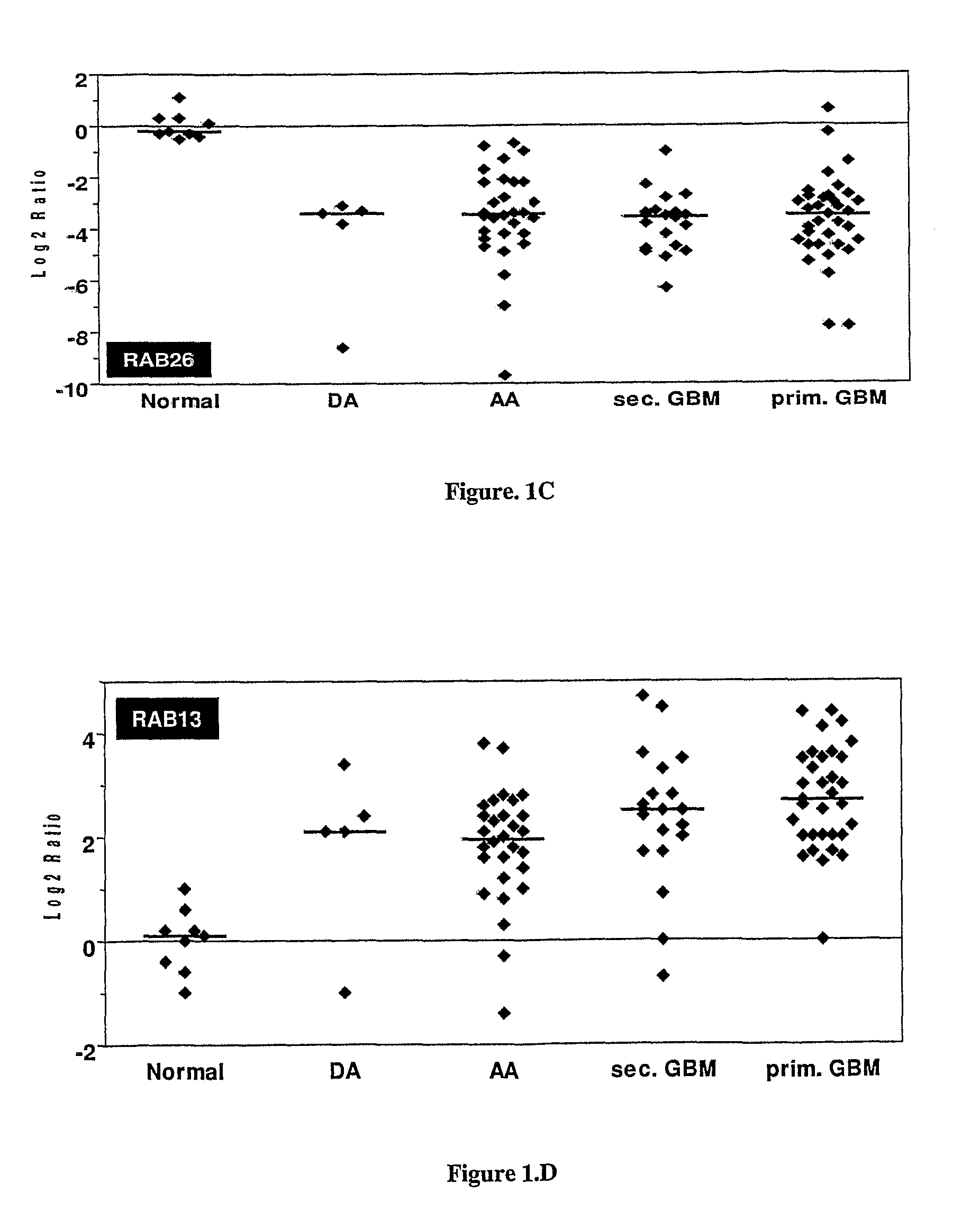 Methods and kits useful for the identification of astrocytoma, it's grades and glioblastoma prognosis