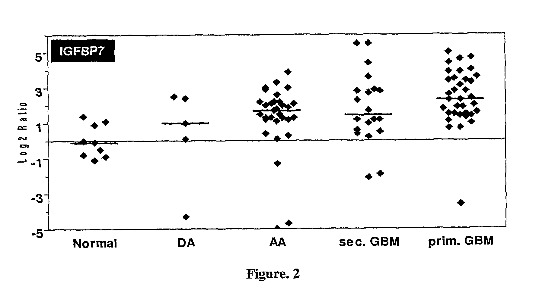 Methods and kits useful for the identification of astrocytoma, it's grades and glioblastoma prognosis