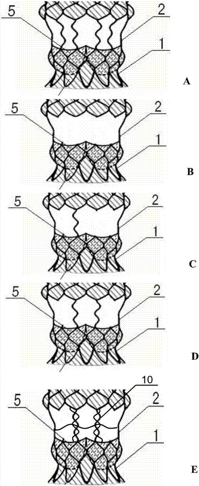 Ascending aorta and aortic valve integrated intravascular stent
