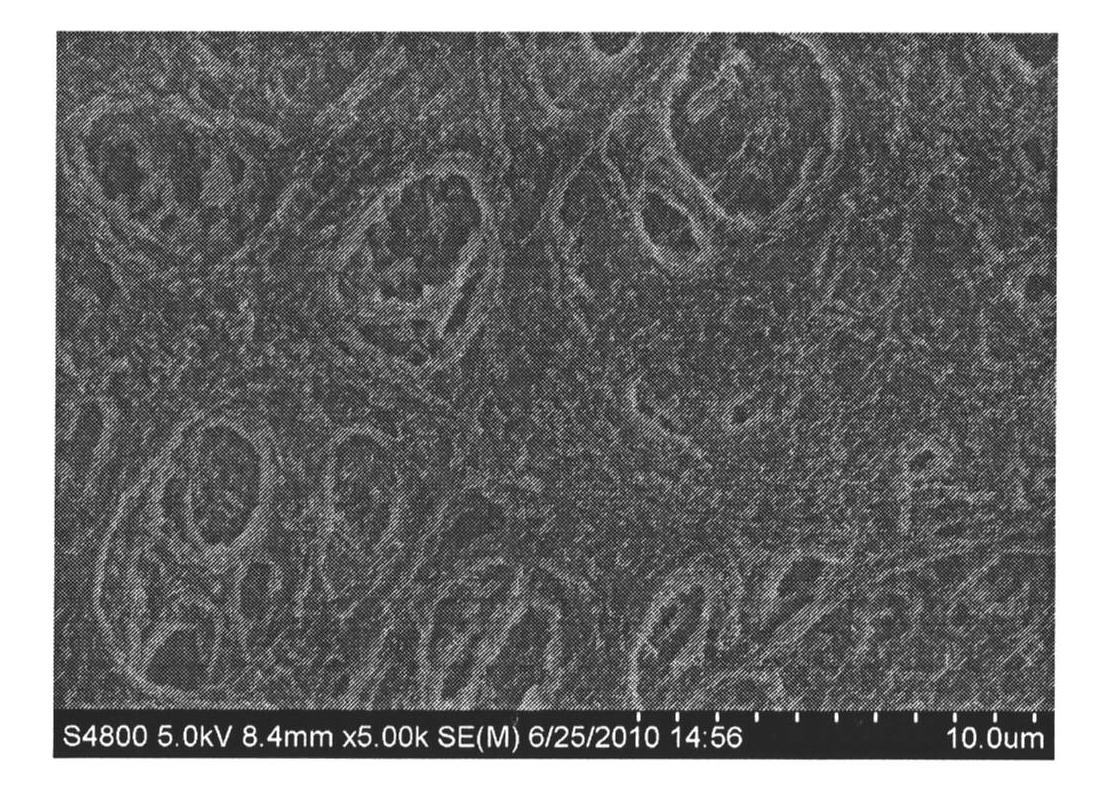 Surface mount method of mineralized collagen gradient coating for medical titanium implant