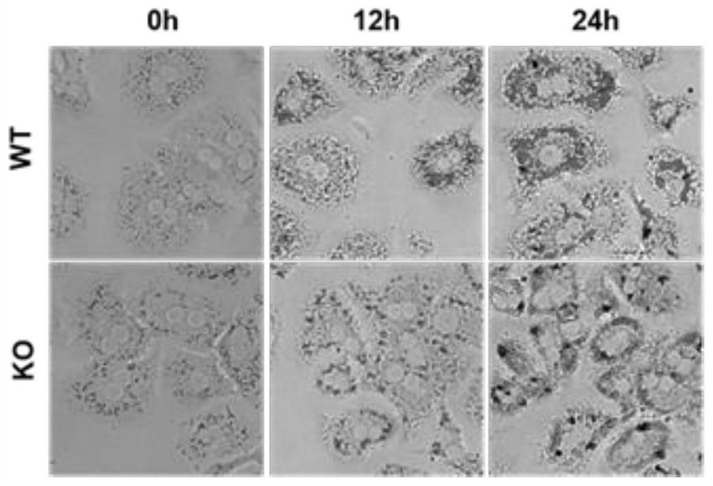 Application of psmb8 and its inhibitors in the preparation of drugs for treating fatty liver and related diseases