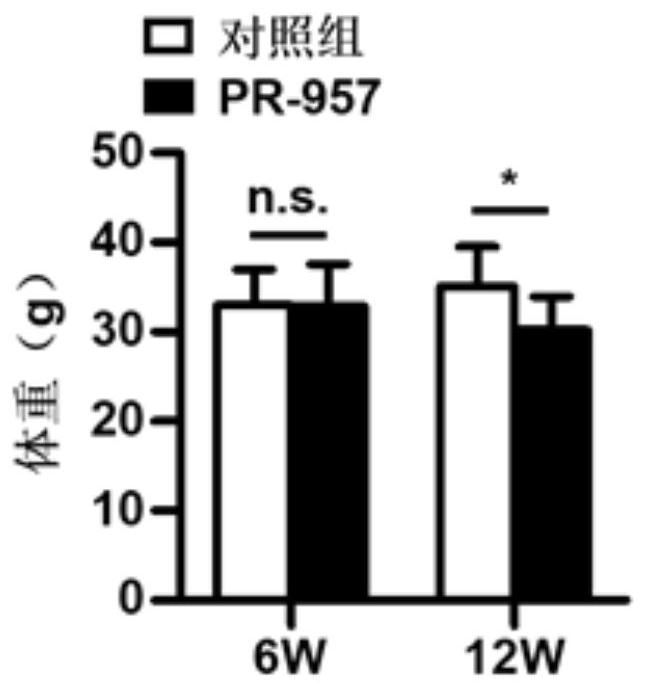 Application of psmb8 and its inhibitors in the preparation of drugs for treating fatty liver and related diseases