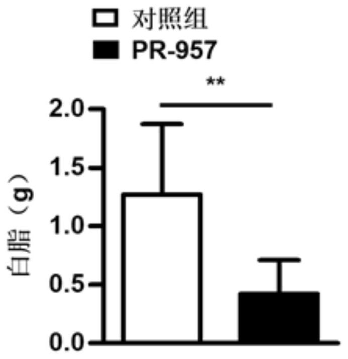 Application of psmb8 and its inhibitors in the preparation of drugs for treating fatty liver and related diseases