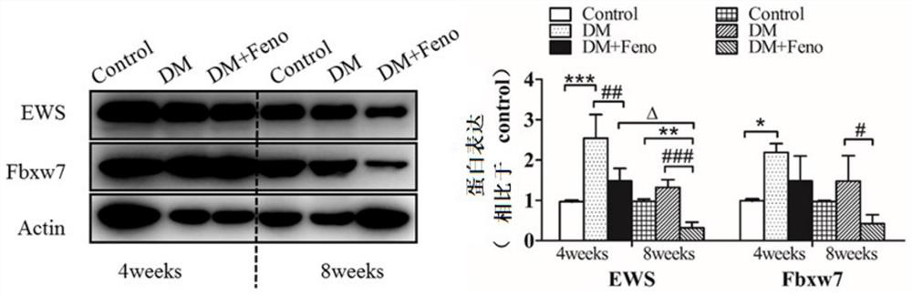 Application of ews or its upregulator in the preparation of medicines for treating diabetes and preventing and treating tumors in individuals with diabetes