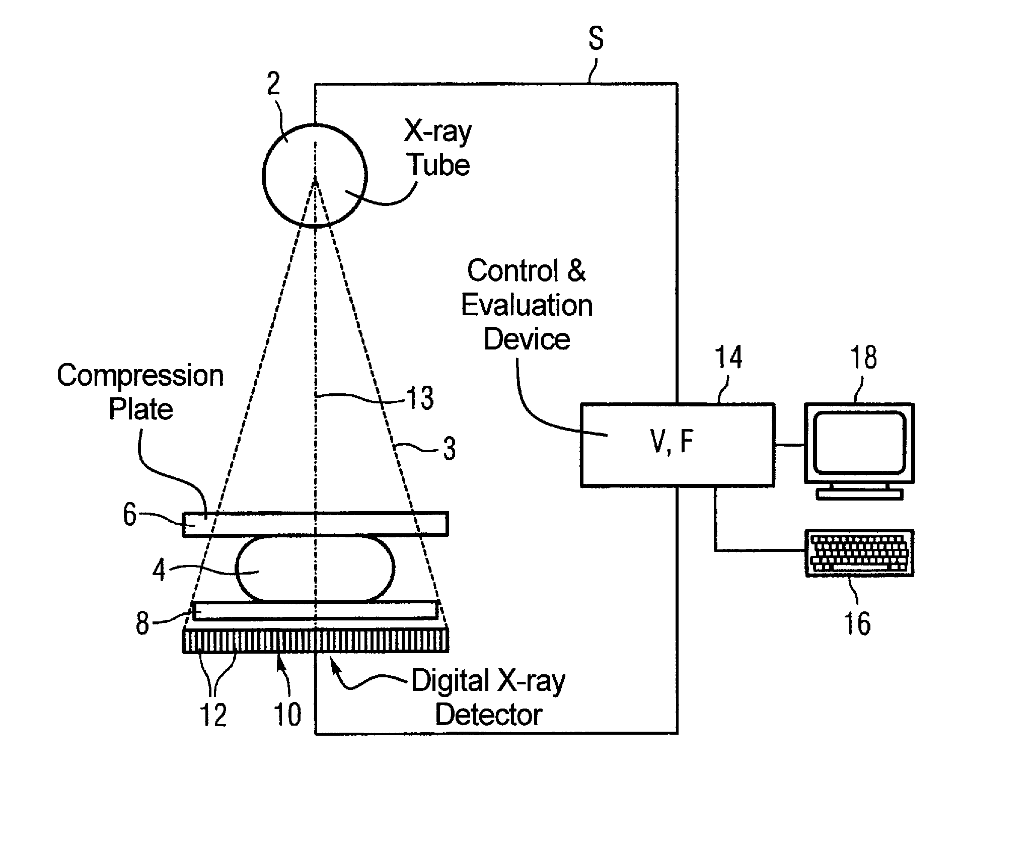 Method and apparatus for generation of a digital x-ray image of an examination subject