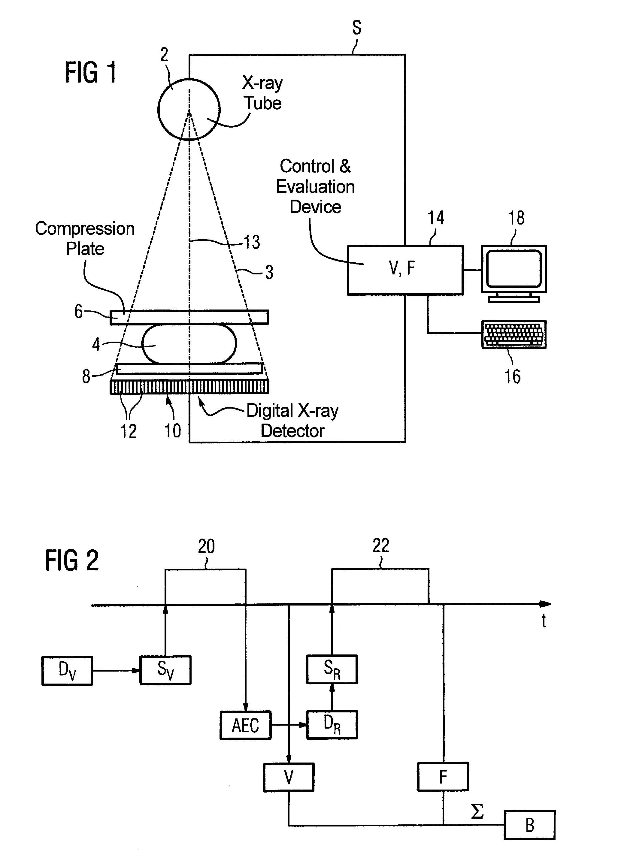 Method and apparatus for generation of a digital x-ray image of an examination subject