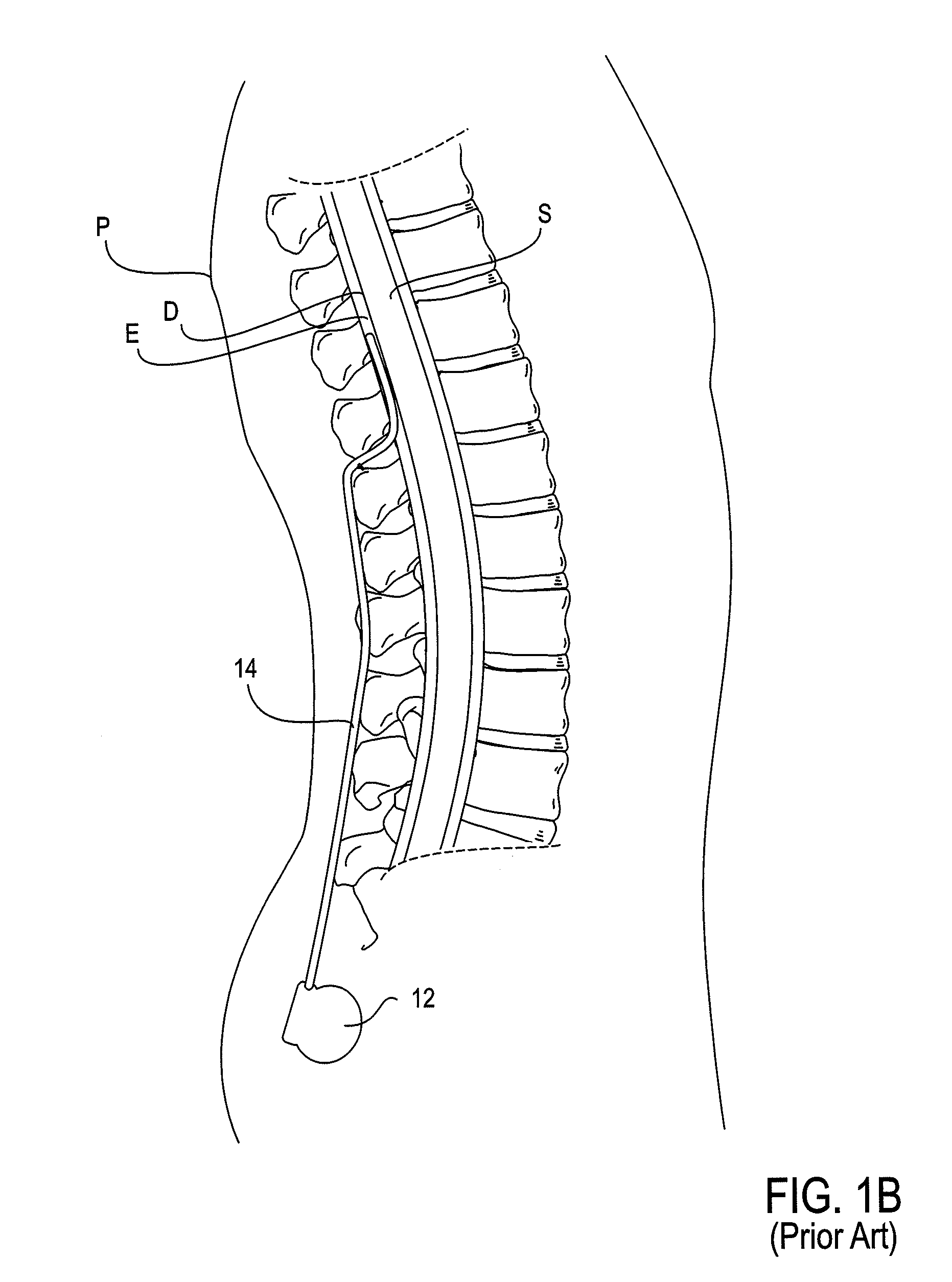 Stimulation leads, delivery systems and methods of use