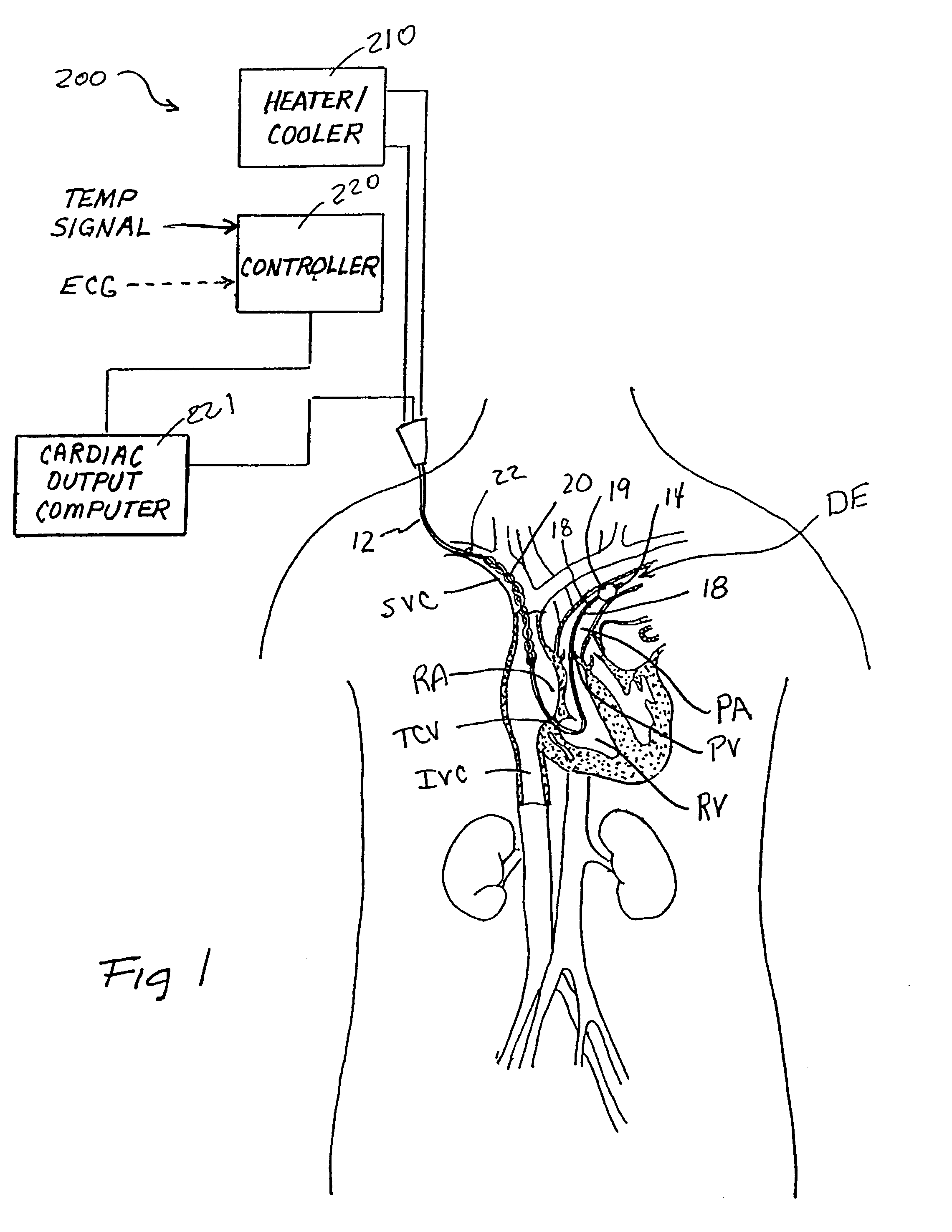 Devices and methods for measuring blood flow rate or cardiac output and for heating or cooling the body