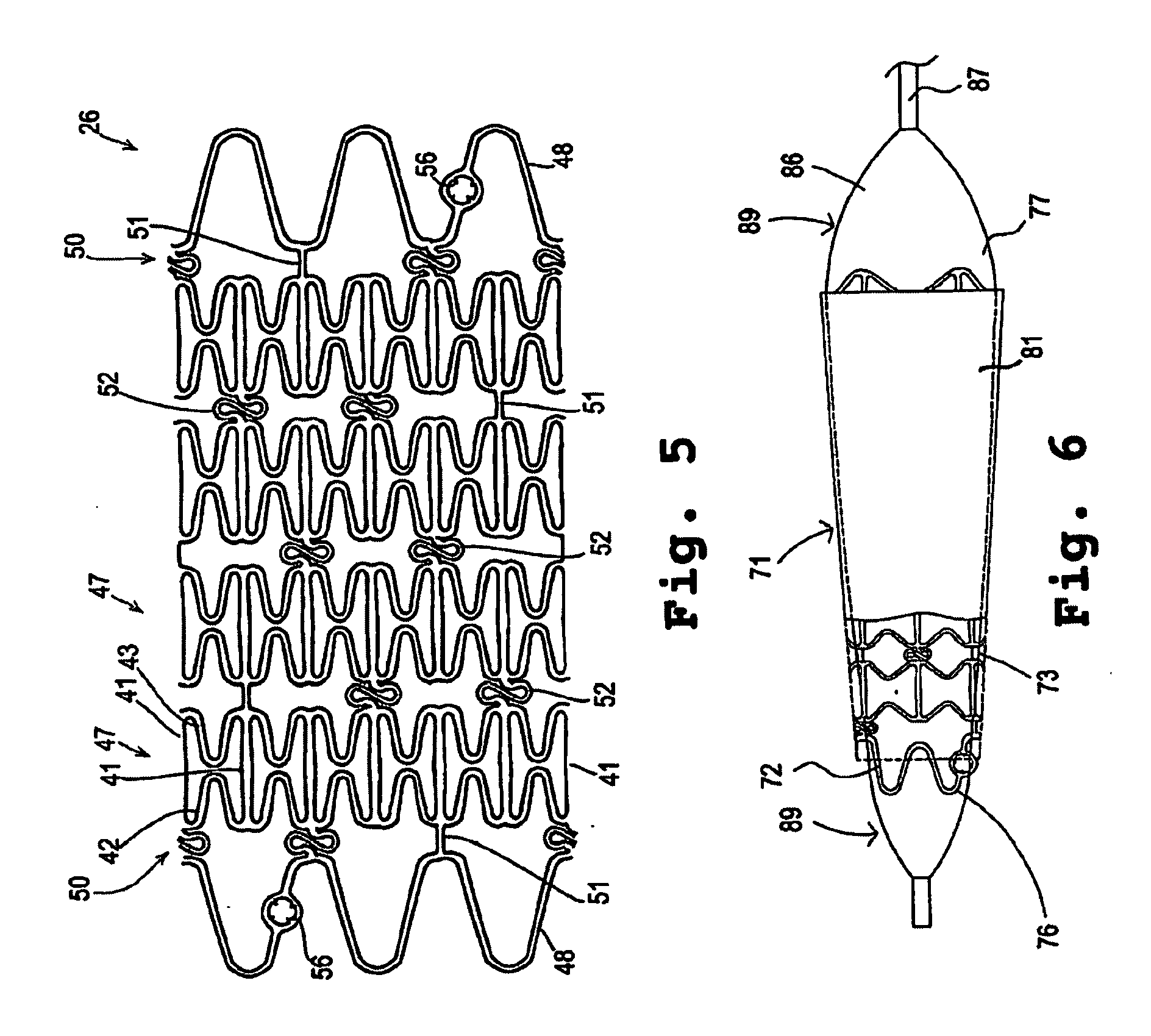 Composite stent with polymeric covering and bioactive coating
