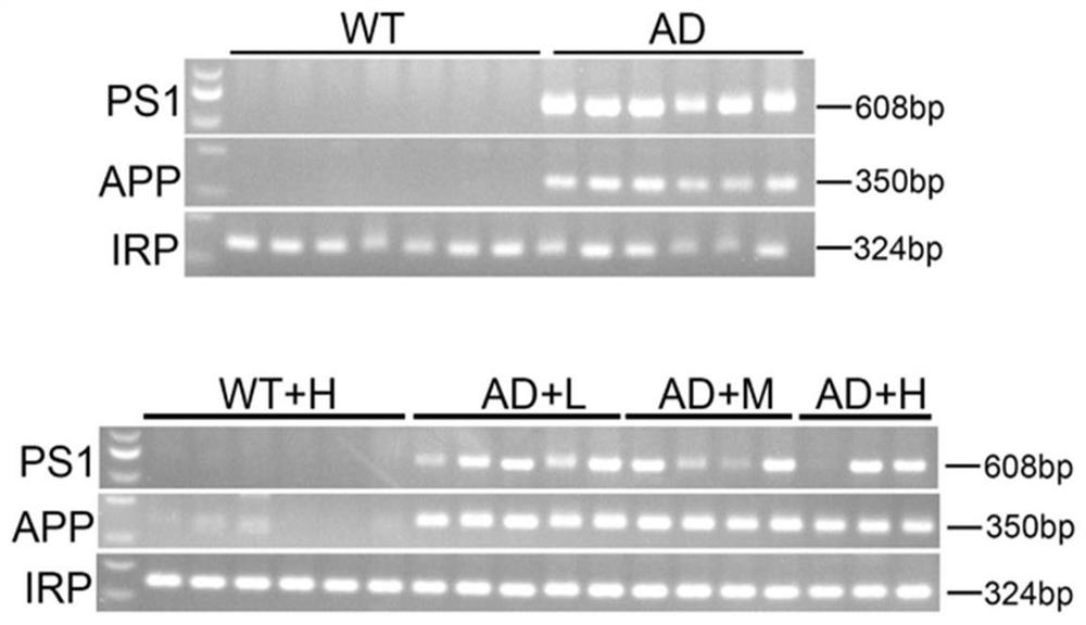 Application of sialic acid to regulation of dyslipidemia caused by abnormal expression of gene causing Alzheimer's disease
