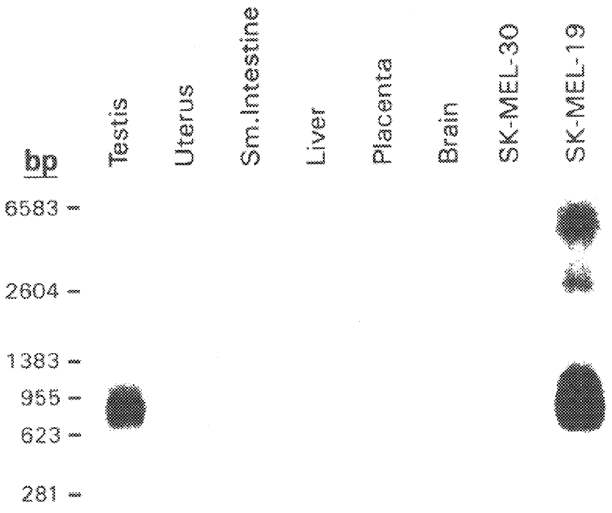 Isolated nucleic acid molecule encoding an esophageal cancer associated antigen, the antigen itself, and uses thereof