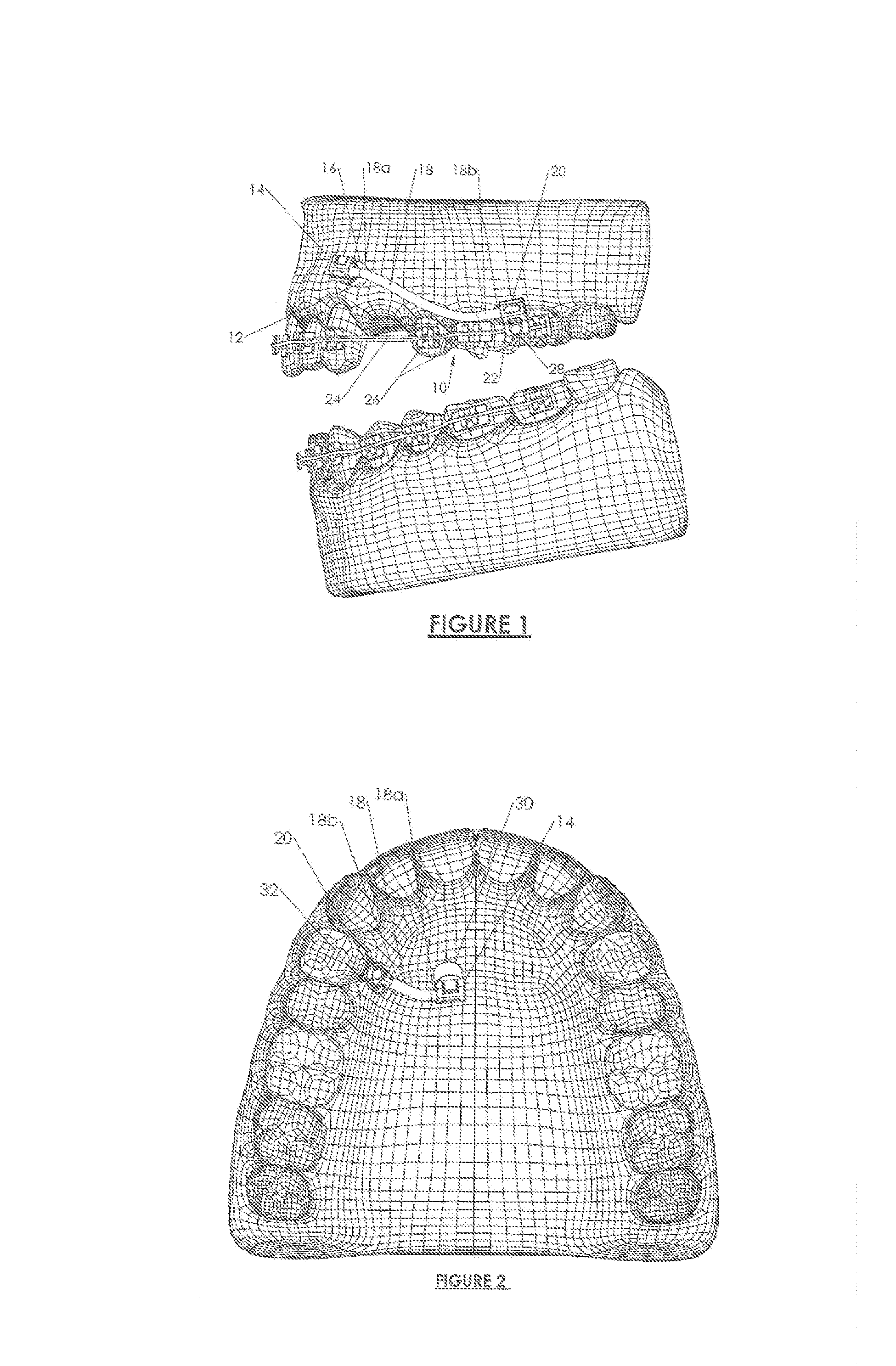Orthodontic anchoring method and apparatus
