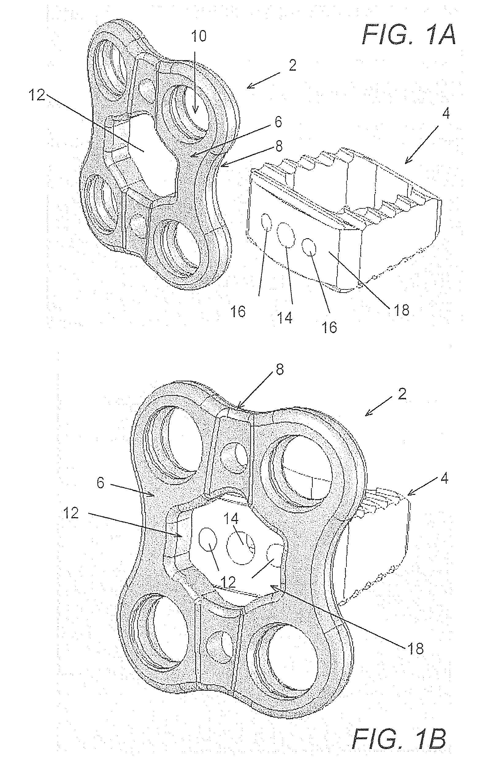 Device and method for delivery of multiple heterogenous orthopedic implants