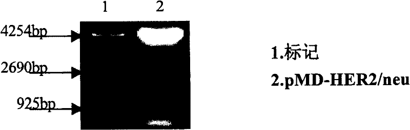 Construction of HER2/neu mRNA in vitro transcription vector and use thereof