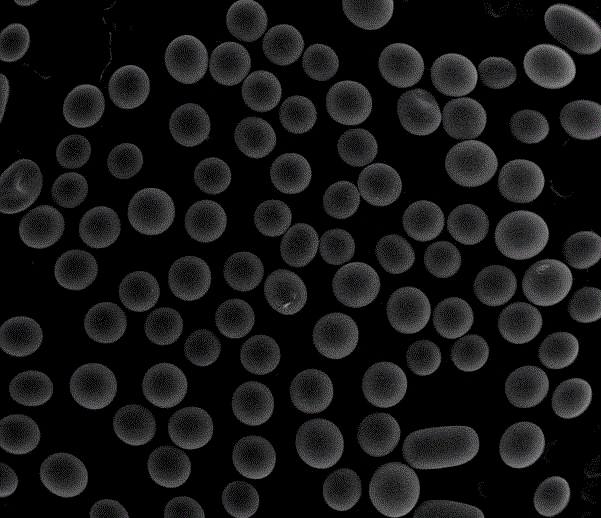 Method for preparing phosphomycin calcium/hexagonal mesoporous silicon/poly glycolide-co-lactide (PLGA) bone tissue stent