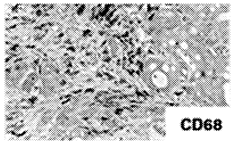 Generation of human macrophages in immunodeficient non-human hosts