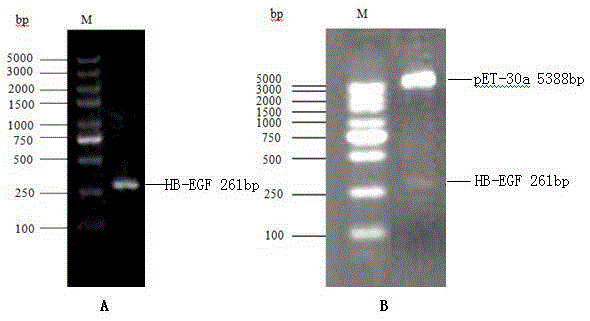 Polypeptides with anticoagulation activity screened by phage display technique