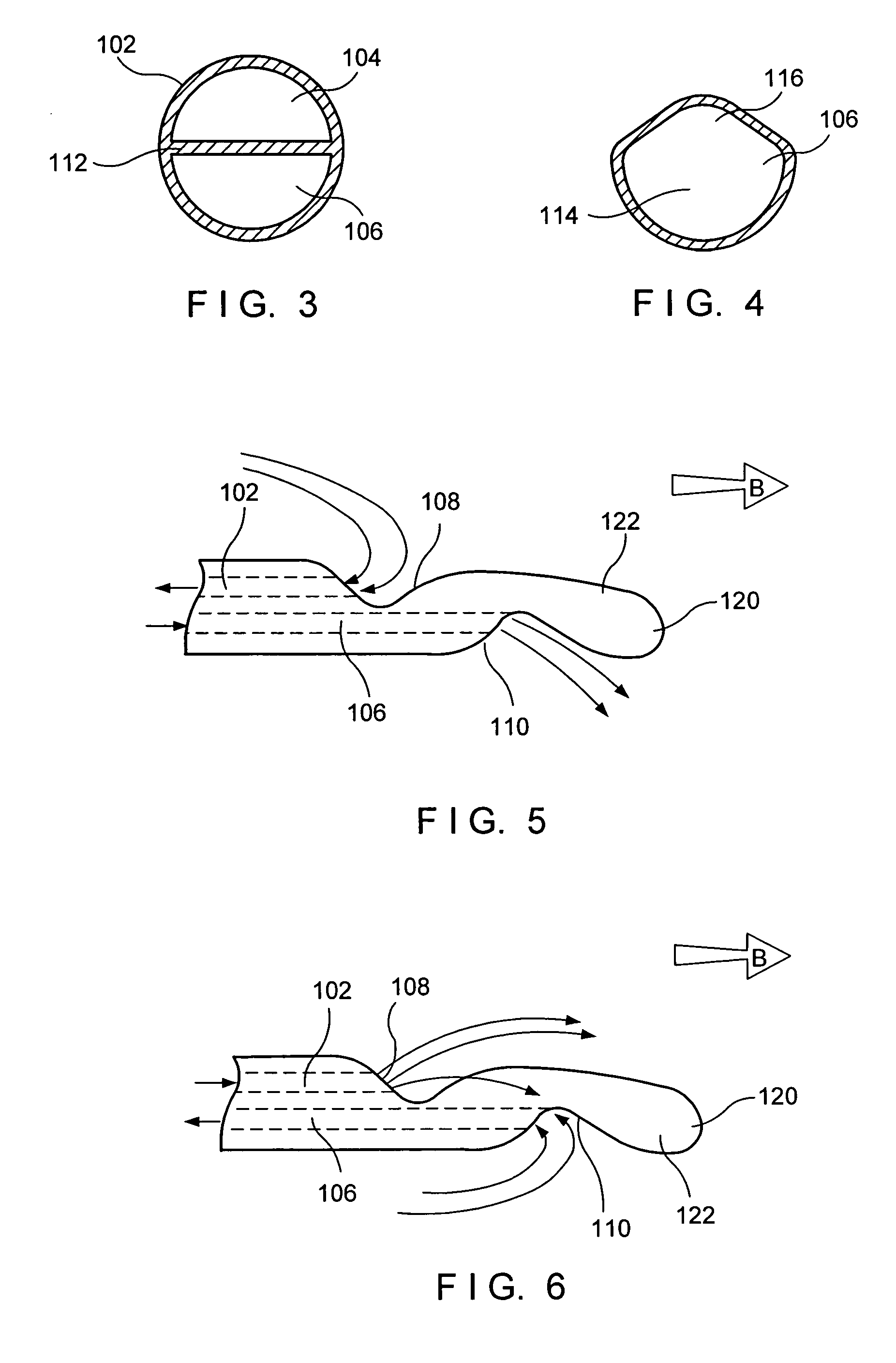 Dialysis catheter tip and method of manufacture