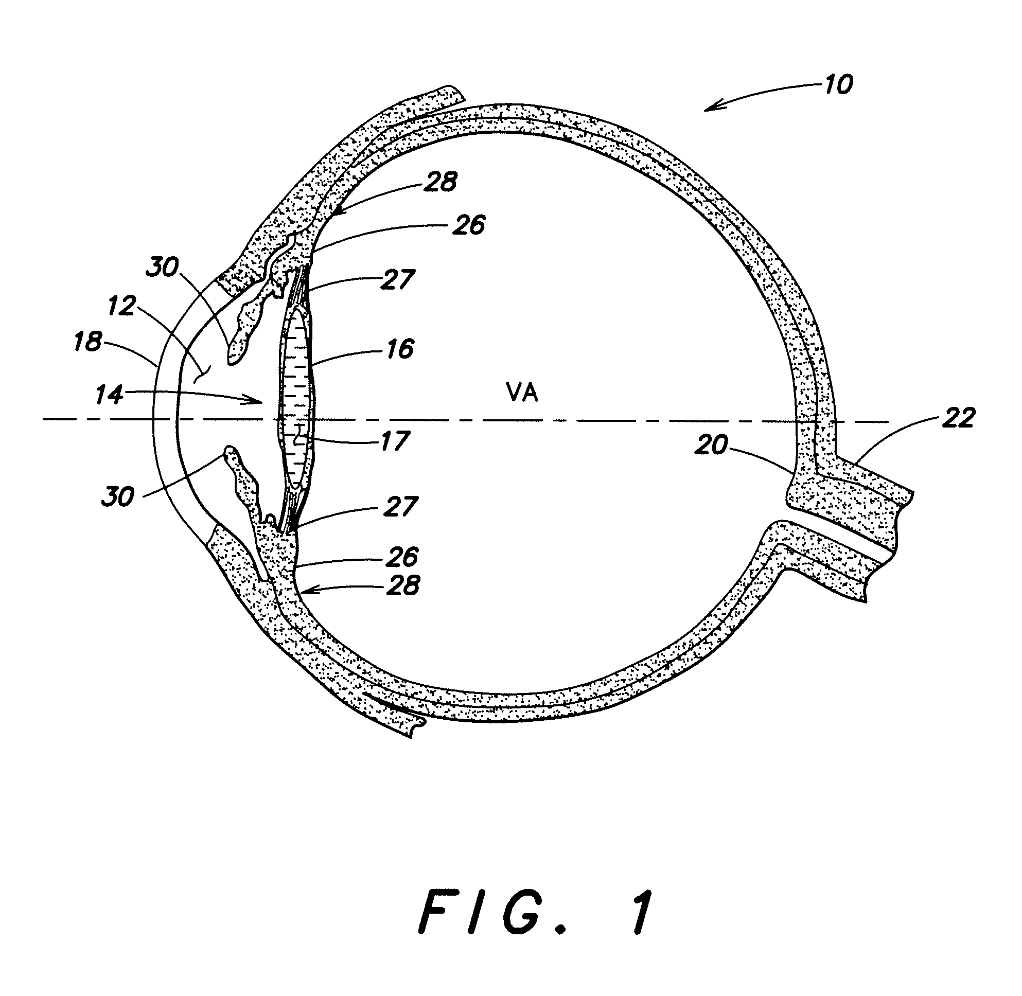 Multi-Element Accommodative Intraocular Lens