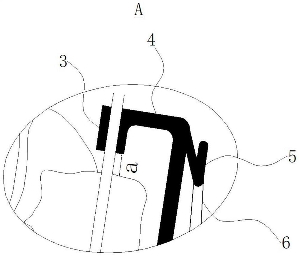 Molar distalization correcting device