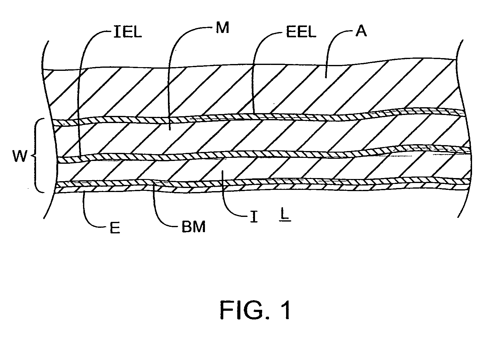 Methods and kits for delivering pharmaceutical agents into the coronary vascular adventitia