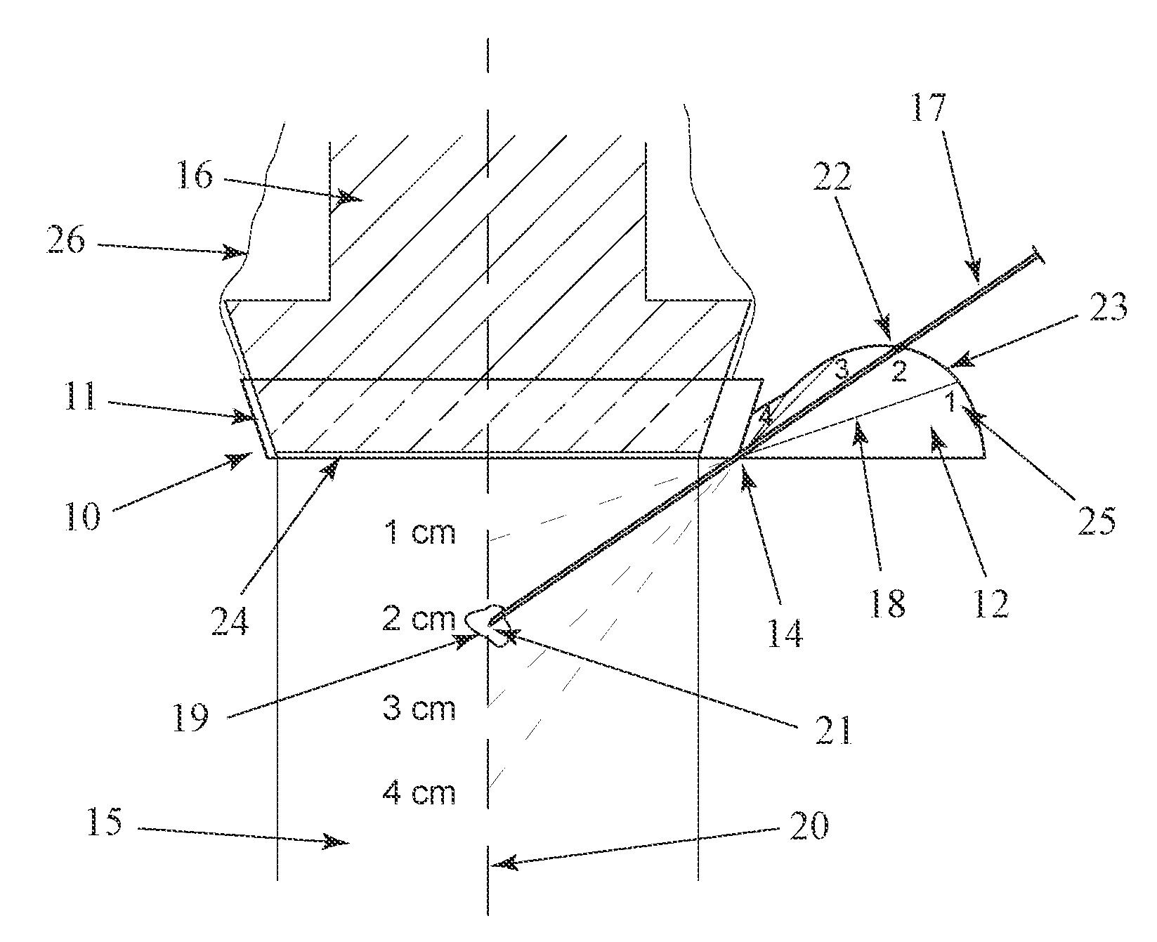 Apparatus for a needle director for an ultrasound transducer probe