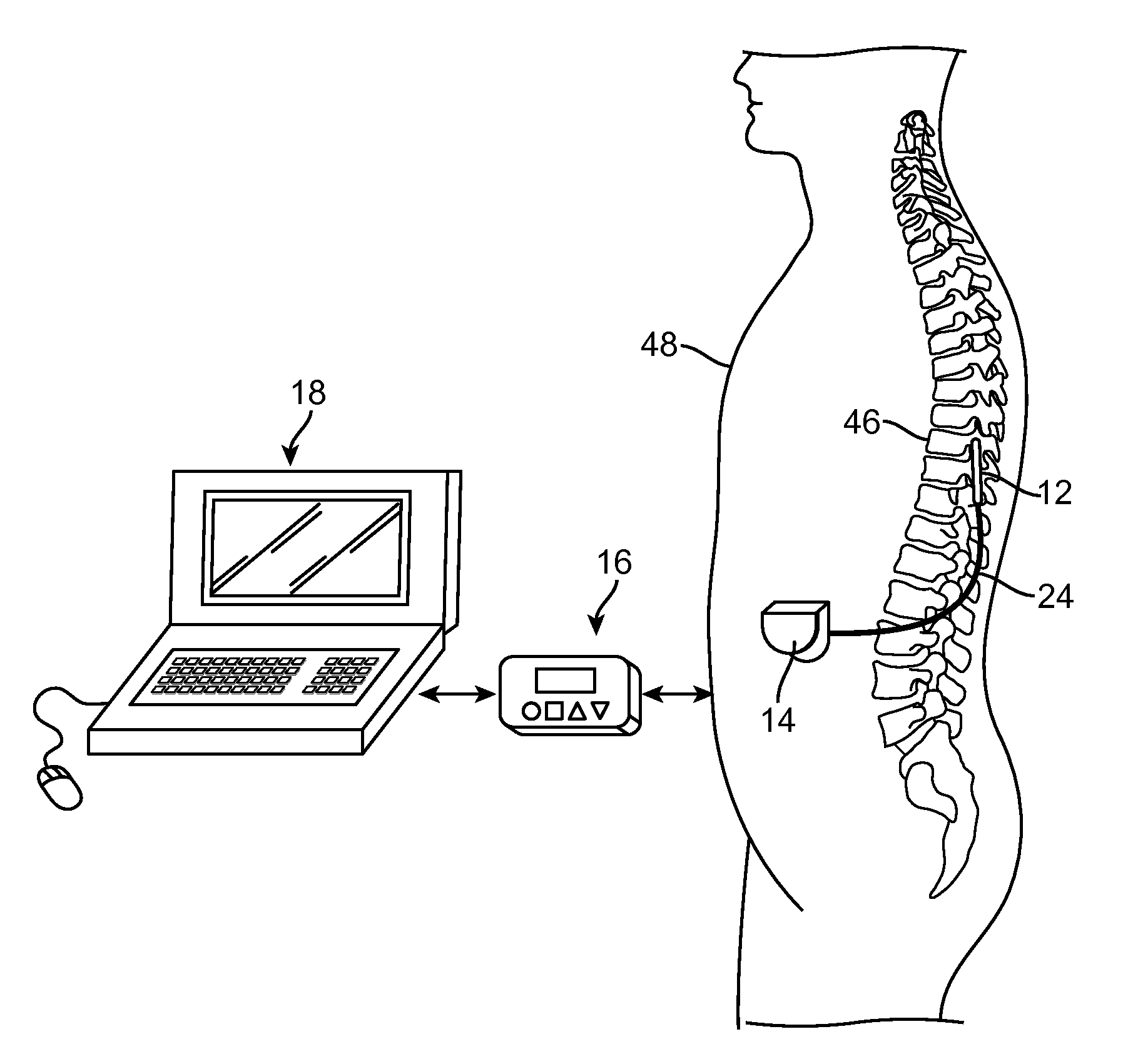 Neuromodulation system and method for reducing energy requirements using feedback