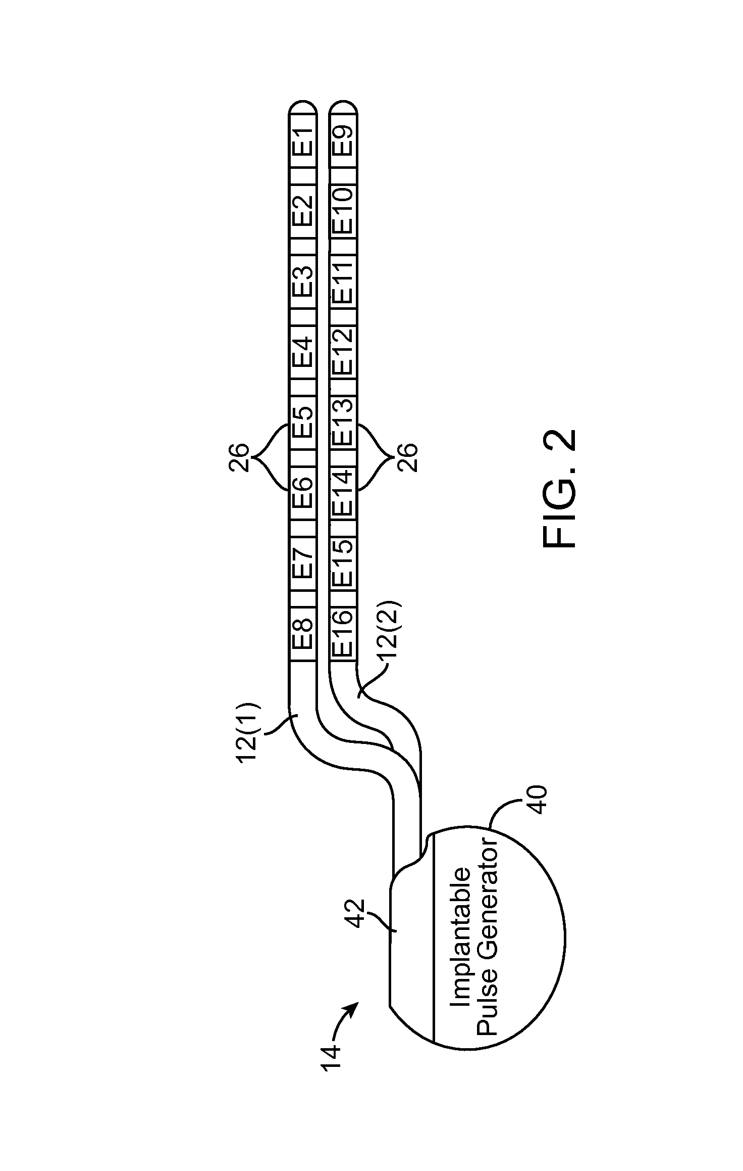 Neuromodulation system and method for reducing energy requirements using feedback