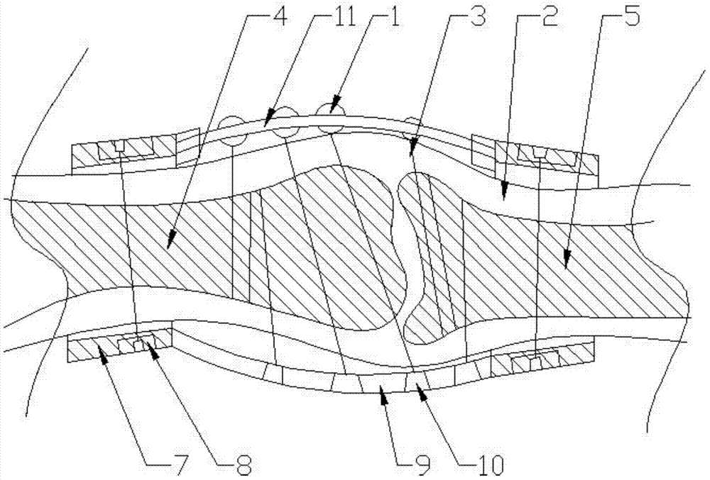 A kind of joint bone external fixator