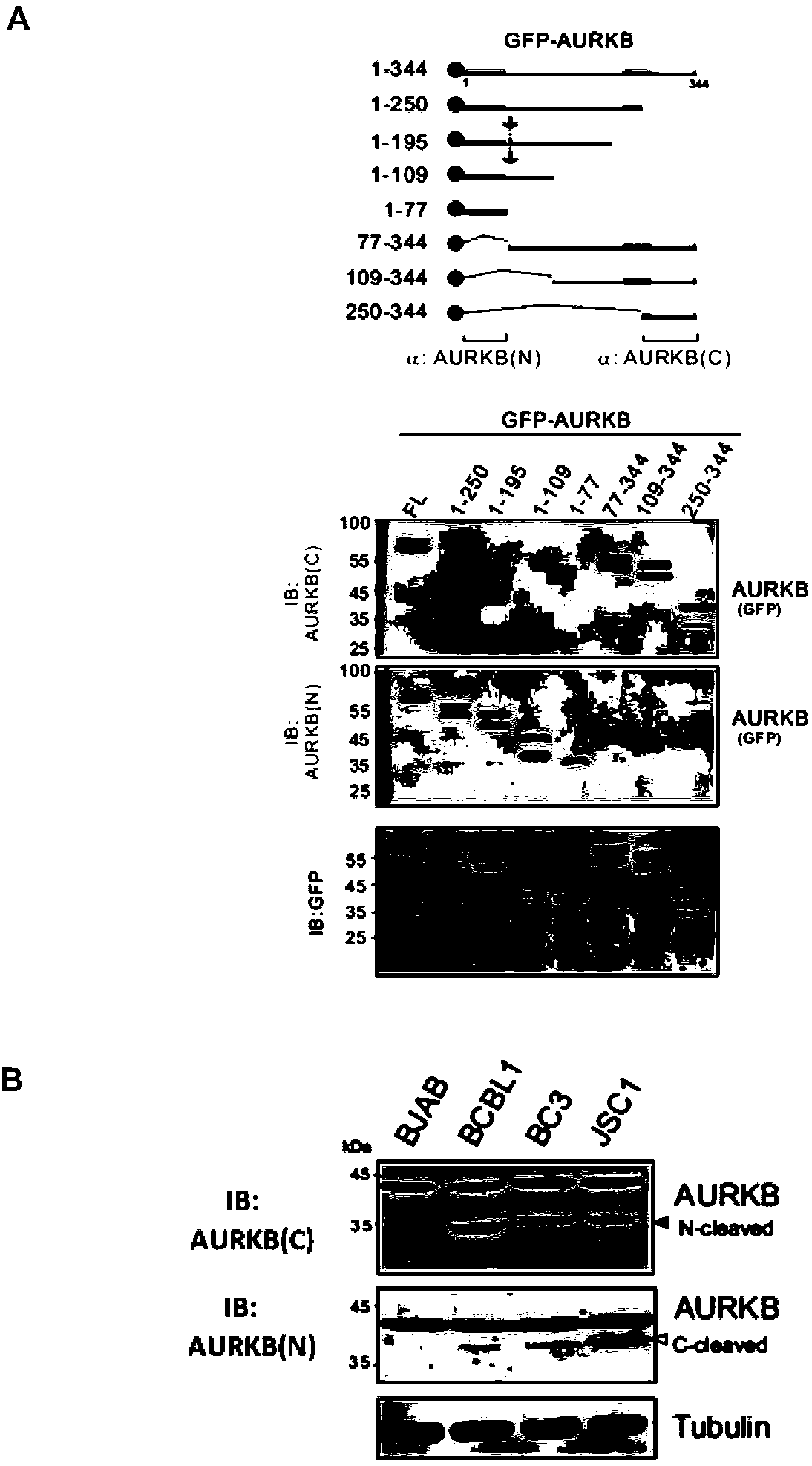 Marker for grading and prognosis of malignant tumors