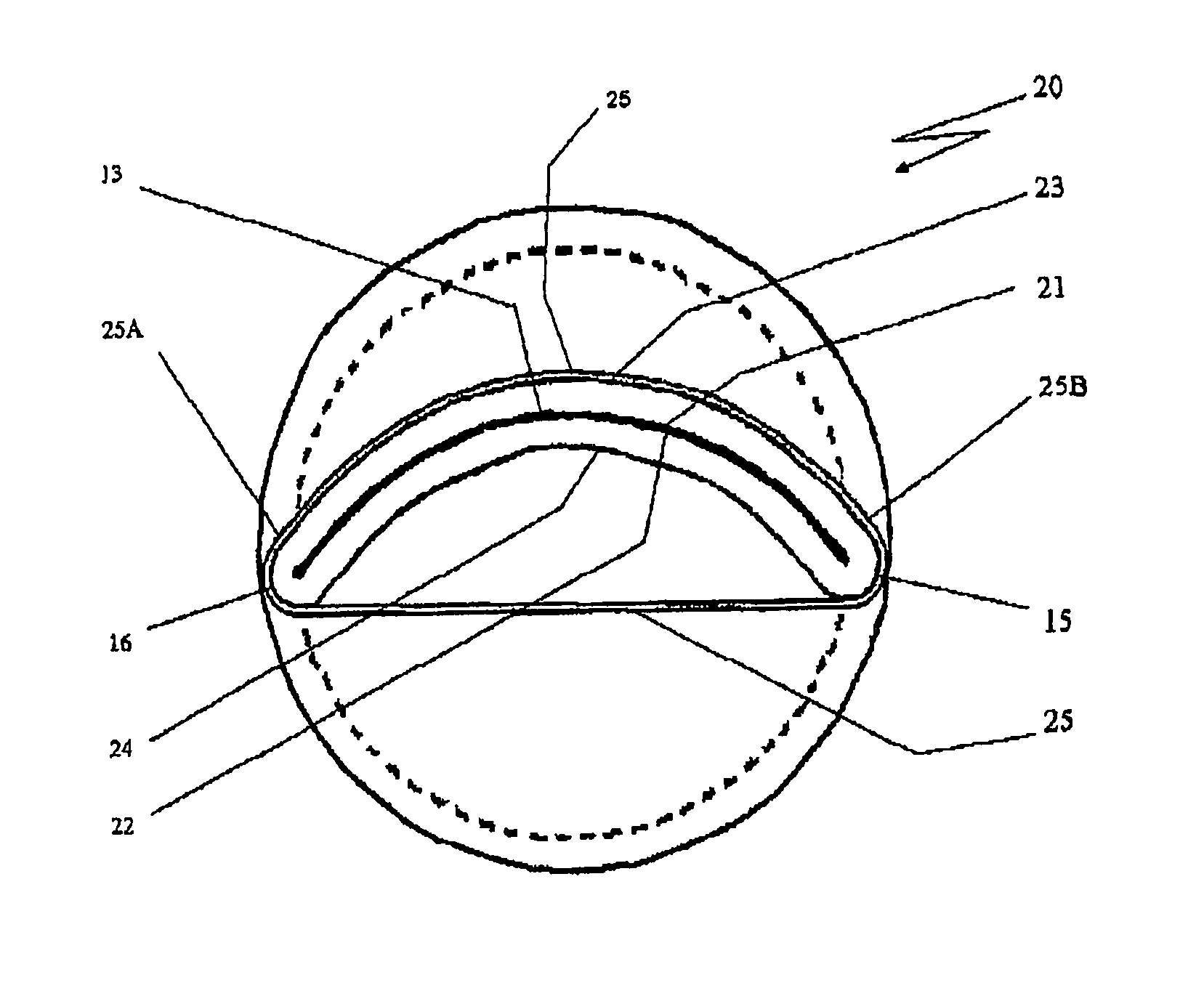 Duckbill type check valve with curved and resiliently biased closing seal