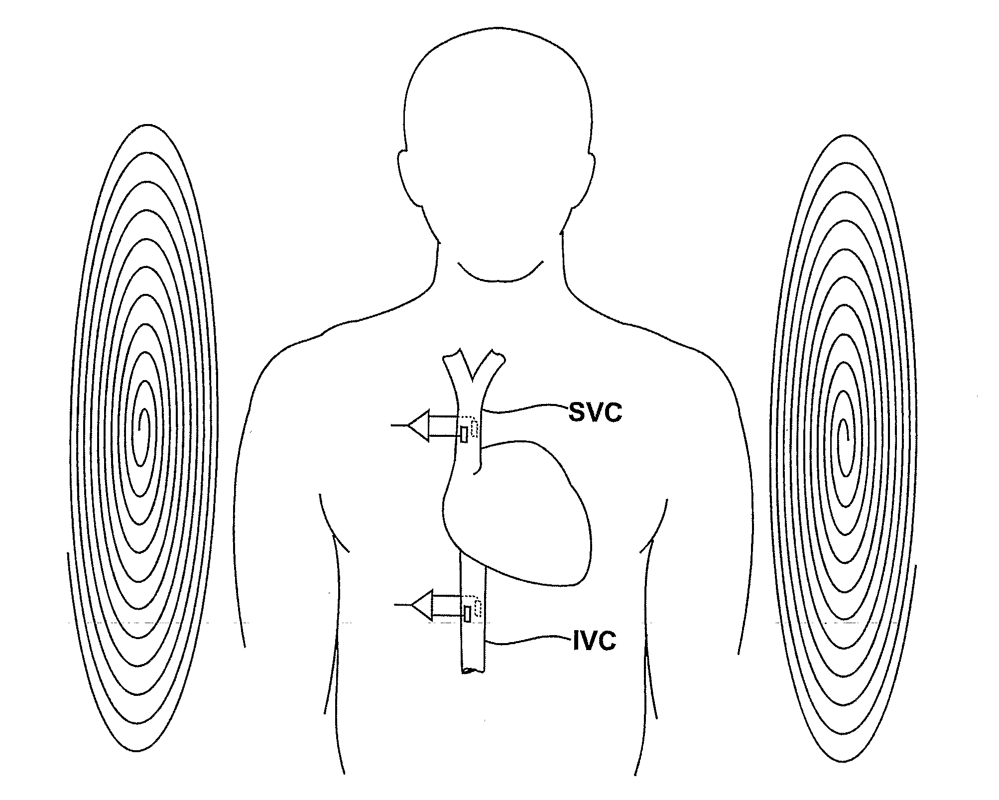 Medical Diagnostic and Treatment Platform Using Near-Field Wireless Communication of Information Within a Patient's Body