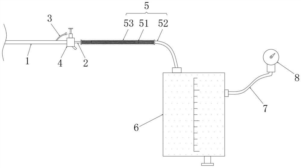 Multifunctional pancreatic trauma peritoneal cavity flushing device