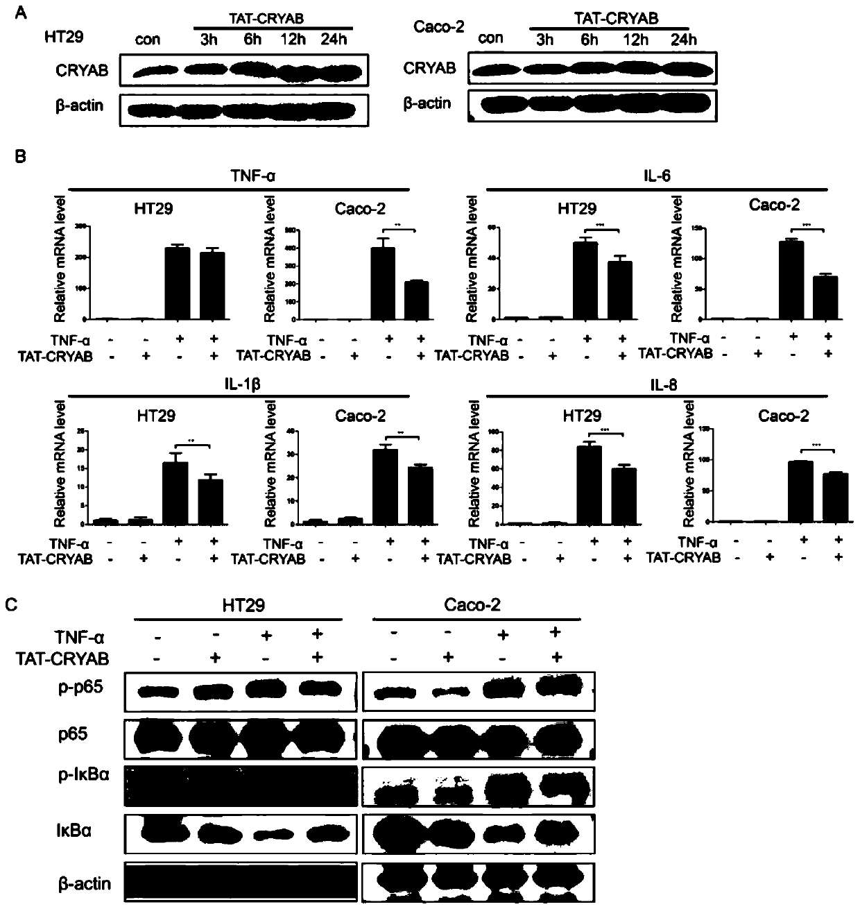 Application method of TAT-CRYAB fusion protein in intestinal inflammation