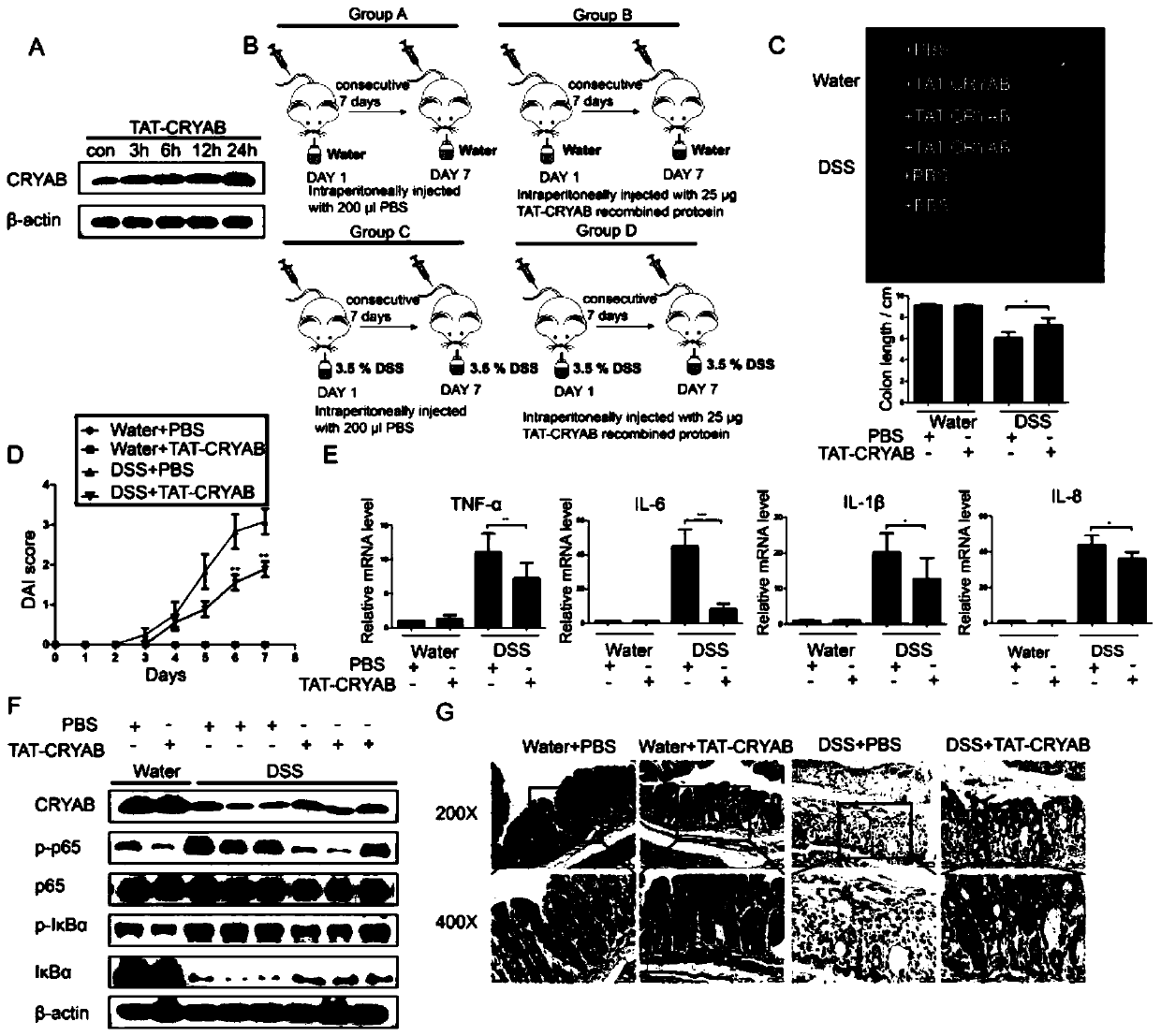 Application method of TAT-CRYAB fusion protein in intestinal inflammation