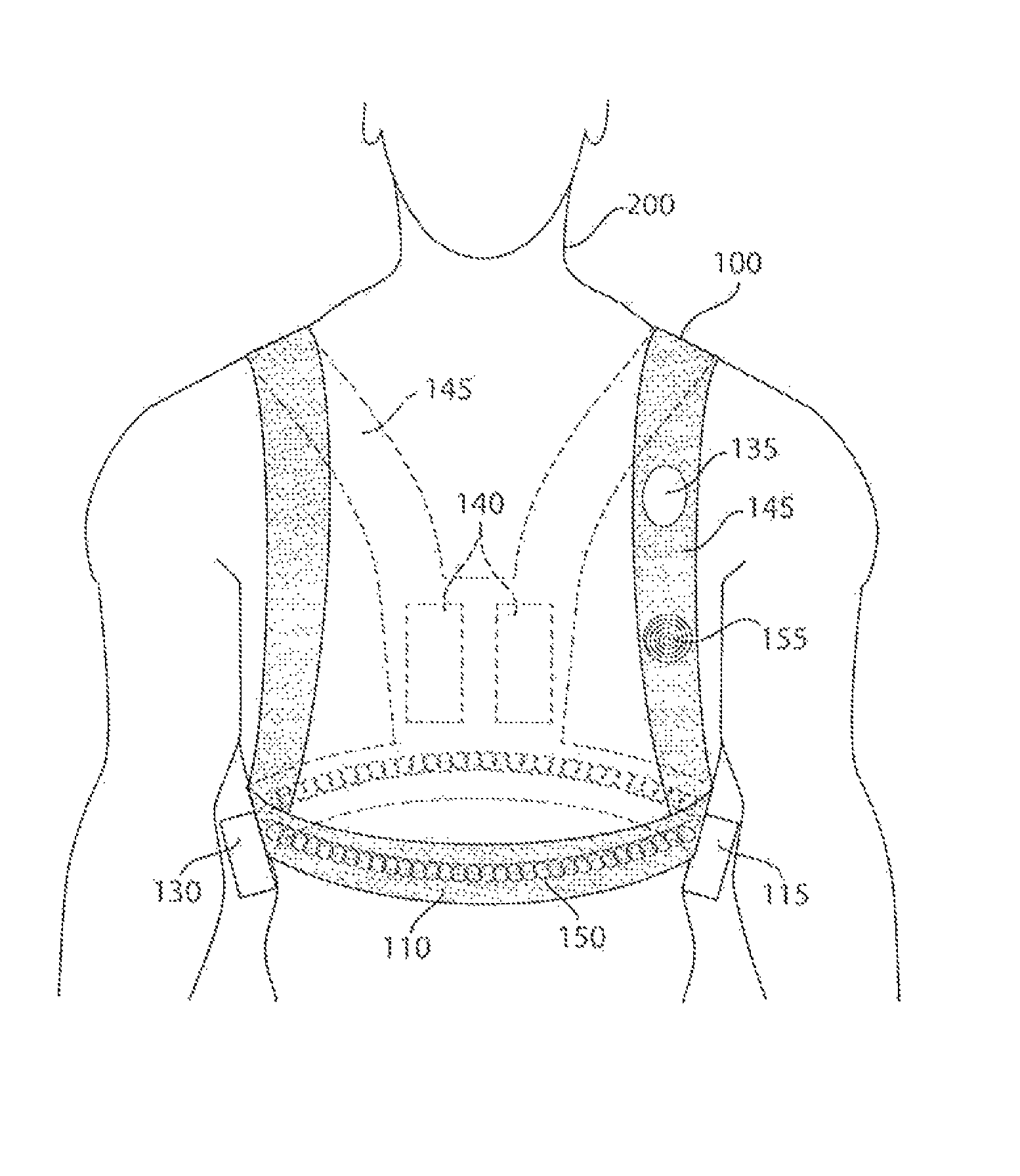 Wearable monitoring and treatment device