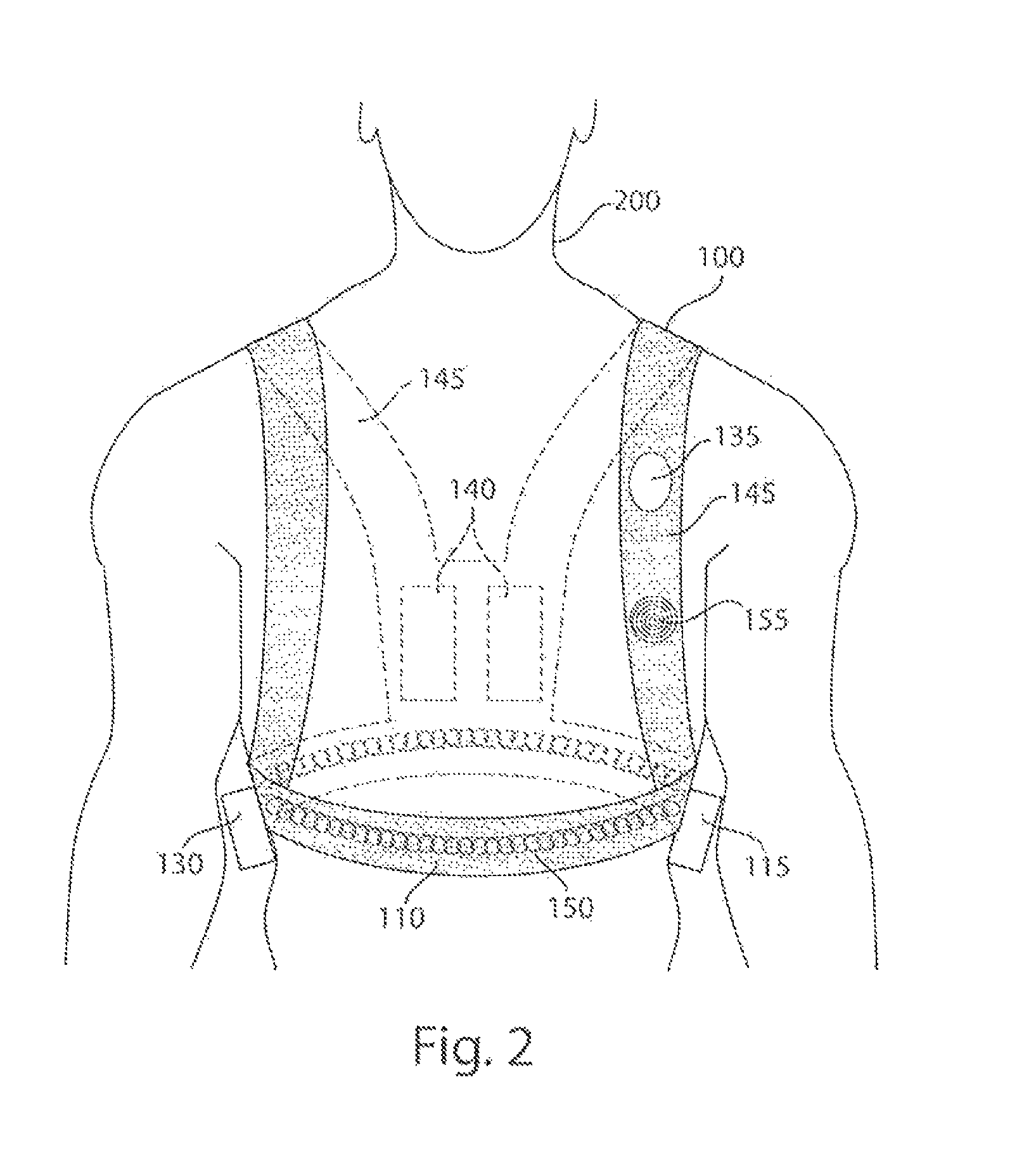 Wearable monitoring and treatment device