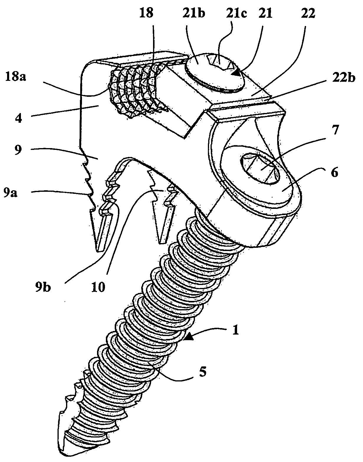 Device comprising anterior plate for vertebral column support
